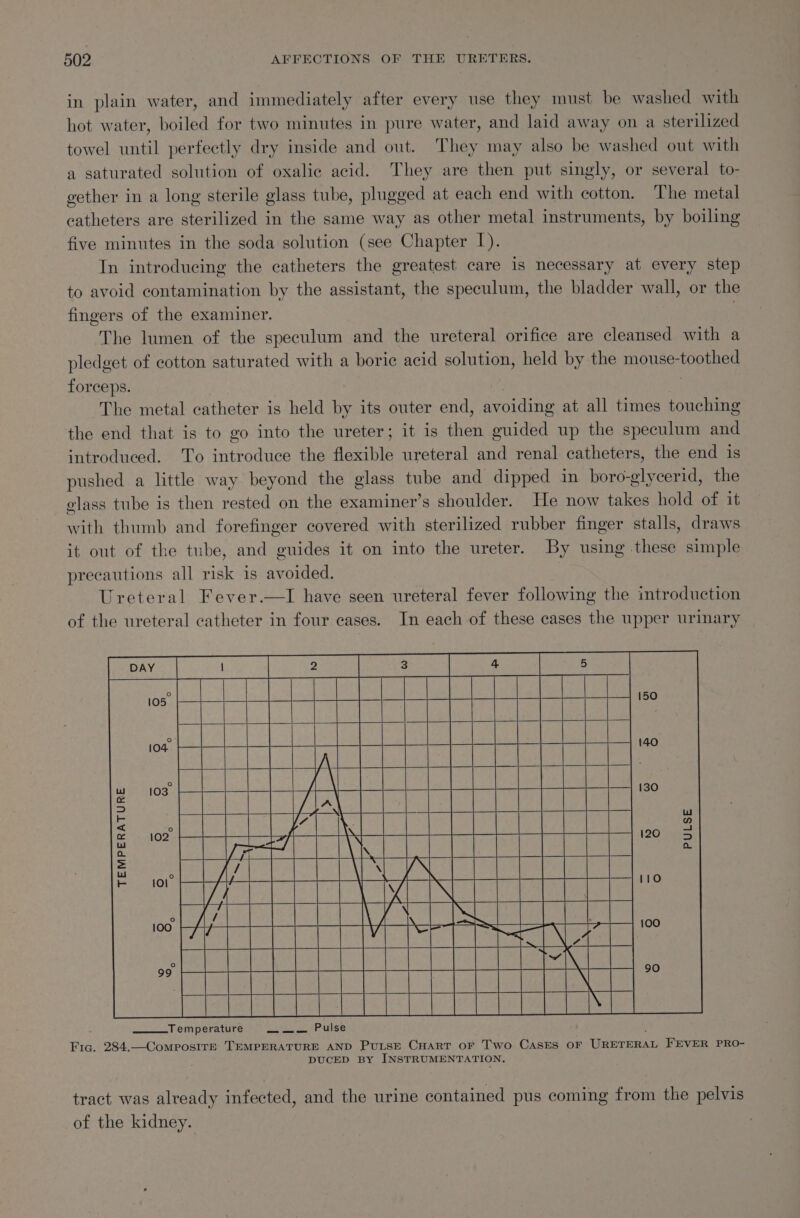 in plain water, and immediately after every use they must be washed with hot water, boiled for two minutes in pure water, and laid away on a sterilized towel until perfectly dry inside and out. They may also be washed out with a saturated solution of oxalic acid. They are then put singly, or several to- gether in a long sterile glass tube, plugged at each end with cotton. The metal catheters are sterilized in the same way as other metal instruments, by boiling five minutes in the soda solution (see Chapter I). In introducing the catheters the greatest care 1s necessary at every step to avoid contamination by the assistant, the speculum, the bladder wall, or the fingers of the examiner. | The lumen of the speculum and the ureteral orifice are cleansed with a pledget of cotton saturated with a boric acid sotna held by the mouse- POM forceps. The metal catheter is held by its outer end, avoiding at all times touching the end that is to go into the ureter; it is ier guided up the speculum and introduced. To introduce the deciie ureteral and renal catheters, the end is pushed a little way beyond the glass tube and dipped in boro-glycerid, the elass tube is then rested on the examiner’s shoulder. He now takes hold of it with thumb and forefinger covered with sterilized rubber finger stalls, draws it out of the tube, and guides it on into the ureter. By using these simple precautions all risk is avoided. Ureteral Fever.—lI have seen ureteral fever following the introduction of the ureteral catheter in four cases. In each of these cases the upper urmary cee SEES RCE 3 CECA SEE ce Jone eam bas HEHE He aa aaa paEe Re por Pulse Fig. 284.—ComposIrE TEMPERATURE AND PULSE CHART OF Two CASES OF Winer ee a) FEVER PRO- DUCED BY INSTRUMENTATION. TEMPERATURE tract was already infected, and the urine contained pus coming from the pelvis of the kidney.
