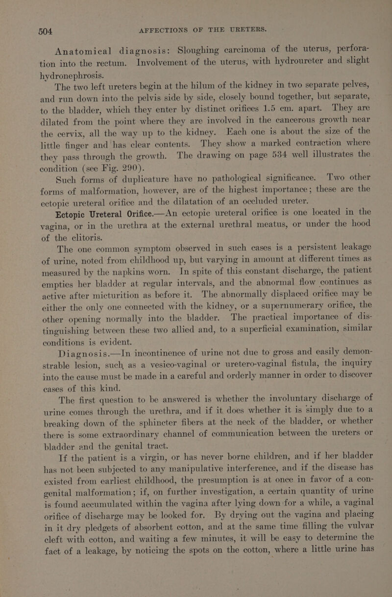 Anatomical diagnosis: Sloughing carcinoma of the uterus, perfora- tion into the rectum. Involvement of the uterus, with hydroureter and slight hydronephrosis. The two left ureters begin at the hilum of the kidney in two separate pelves, and run down into the pelvis side by side, closely bound together, but separate, to the bladder, which they enter by distinct orifices 1.5 em. apart. They are dilated from the point where they are involved in the cancerous growth near the cervix, all the way up to the kidney. Each one is about the size of the little finger and has clear contents. They show a marked contraction where they pass through the growth. The drawing on page 534 well illustrates the. condition (see Fig. 290). Such forms of duplicature have no pathological significance. Two other forms of malformation, however, are of the highest importance; these are the ectopic ureteral orifice and the dilatation of an occluded ureter. Ectopic Ureteral Orifice—An ectopic ureteral orifice is one located in the vagina, or in the urethra at the external urethral meatus, or under the hood of the clitoris. The one common symptom observed in such cases is a persistent leakage of urine, noted from childhood up, but varying in amount at different times as measured by the napkins worn. In spite of this constant discharge, the patient . empties her bladder at regular intervals, and the abnormal flow continues as active after micturition as before it. The abnormally displaced orifice may be either the only one connected with the kidney, or a supernumerary orifice, the other opening normally into the bladder. The practical importance of dis- tinguishing between these two allied and, to a superficial examination, similar conditions is evident. Sian Diagnosis.—In incontinence of urine not due to gross and easily demon- strable lesion, such, as a vesico-vaginal or uretero-vaginal fistula, the inquiry into the cause must be made in a careful and orderly manner in order to discover cases of this kind. | The first question to be answered is whether the involuntary discharge of urine comes through the urethra, and if it. does whether it 1s simply due to a breaking down of the sphincter fibers at the neck of the bladder, or whether there is some extraordinary channel of communication between the ureters or bladder and the genital tract. | If the patient is a virgin, or has never borne children, and if her bladder has not been subjected to any manipulative interference, and if the disease has existed from earliest childhood, the presumption is at once in favor of a con- genital malformation; if, on further investigation, a certain quantity of urine is found accumulated within the vagina after lying down for a while, a vaginal — orifice of discharge may be looked for. By drying out the vagina and placing in it dry pledgets of absorbent cotton, and at the same time filling the vulvar cleft with cotton, and waiting a few minutes, it will be easy to determine the fact of a leakage, by noticing the spots on the cotton, where a little urine has