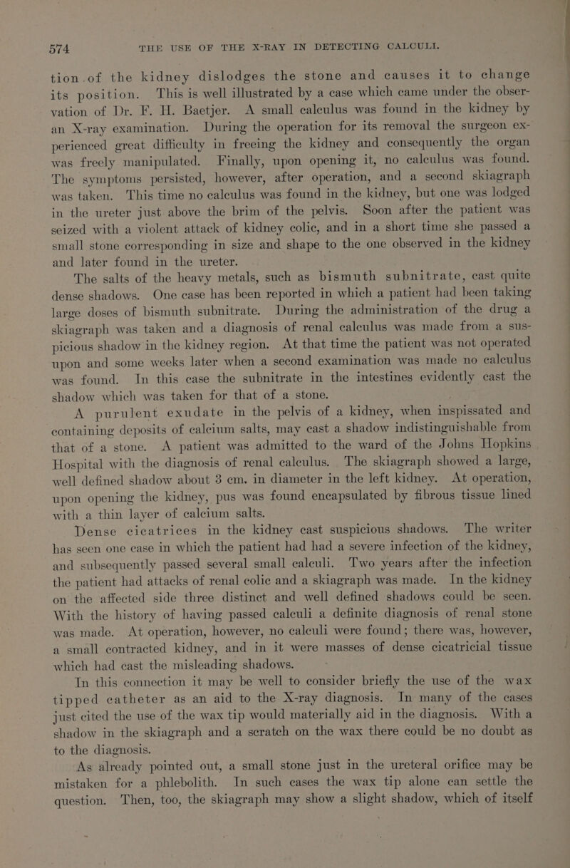 tion.of the kidney dislodges the stone and causes it to change its position. This is well illustrated by a case which came under the obser- vation of Dr. F. H. Baetjer. A small calculus was found in the kidney by an X-ray examination. During the operation for its removal the surgeon ex- perienced great difficulty in freeing the kidney and consequently the organ was freely manipulated. Finally, upon opening it, no calculus was found. The symptoms persisted, however, after operation, and a second skiagraph was taken. This time no calculus was found in the kidney, but one was lodged in the ureter just above the brim of the pelvis. Soon after the patient was seized with a violent attack of kidney colic, and in a short time she passed a small stone corresponding in size and shape to the one observed in the kidney and later found in the ureter. The salts of the heavy metals, such as bismuth subnitrate, cast quite dense shadows. One case has been reported in which a patient had been taking large doses of bismuth subnitrate. During the administration of the drug a skiagraph was taken and a diagnosis of renal calculus was made from a sus- picious shadow in the kidney region. At that time the patient was not operated upon and some weeks later when a second examination was made no calculus was found. In this case the subnitrate in the intestines evidently cast the shadow which was taken for that of a stone. eas A purulent exudate in the pelvis of a kidney, when inspissated and containing deposits of calcium salts, may cast a shadow indistinguishable from that of a stone. A patient was admitted to the ward of the Johns Hopkins Hospital with the diagnosis of renal calculus. The skiagraph showed a large, well defined shadow about 3 em. in diameter in the left kidney. At operation, upon opening the kidney, pus was found encapsulated by fibrous tissue lined with a thin layer of calcium salts. | Dense cicatrices in the kidney cast suspicious shadows. The writer has seen one case in which the patient had had a severe infection of the kidney, and subsequently passed several small ealculi. Two years after the infection the patient had attacks of renal colic and a skiagraph was made. In the kidney on the affected side three distinct and well defined shadows could be seen. With the history of having passed calculi a definite diagnosis of renal stone was made. At operation, however, no calculi were found; there was, however, a small contracted kidney, and in it were masses of dense cicatricial tissue which had cast the misleading shadows. Tn this connection it may be well to consider briefly the use of the wax tipped catheter as an aid to the X-ray diagnosis. In many of the cases just cited the use of the wax tip would materially aid in the diagnosis. With a shadow in the skiagraph and a scratch on the wax there could be no doubt as to the diagnosis. As already pointed out, a small stone just in the ureteral orifice may be mistaken for a phlebolith. In such cases the wax tip alone can settle the question. Then, too, the skiagraph may show a slight shadow, which of itself