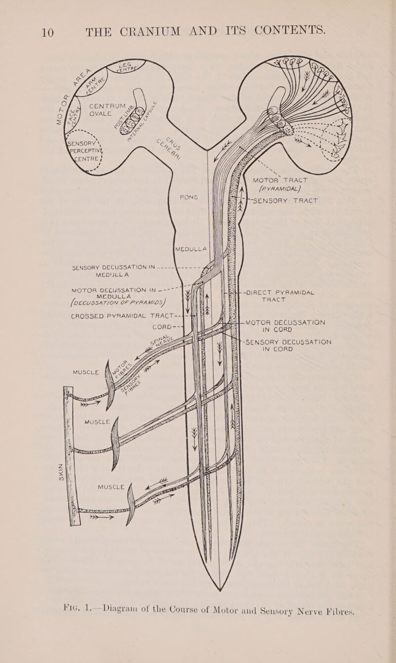 LEG Pp ENTR &amp; WS o&amp; ip es, &amp; CENTRUM OVALE . eS ENSORY Tos PERCEPTIVE eS YX ENTREE, / a” PONS MEDULLA SENSORY DECUSSATION IN -----\_----- MEQULLA MOTOR DECUSSATION IN ~---~ Jy MEDULLA [DECUSSATION OF PYRAMIDS) CROSSED PYRAMIDAL TRACT-- i CORB == Diagram of the Course of Motor MOTOR TRACT (PYRAMIDAL) “SENSORY TRACT -DIRECT PYRAMIDAL TERA Gata 4 MOTOR DECUSSATION 3 IN CORD ~SENSORY DECUSSATION IN CORD aud Sensory Nerve Fibres