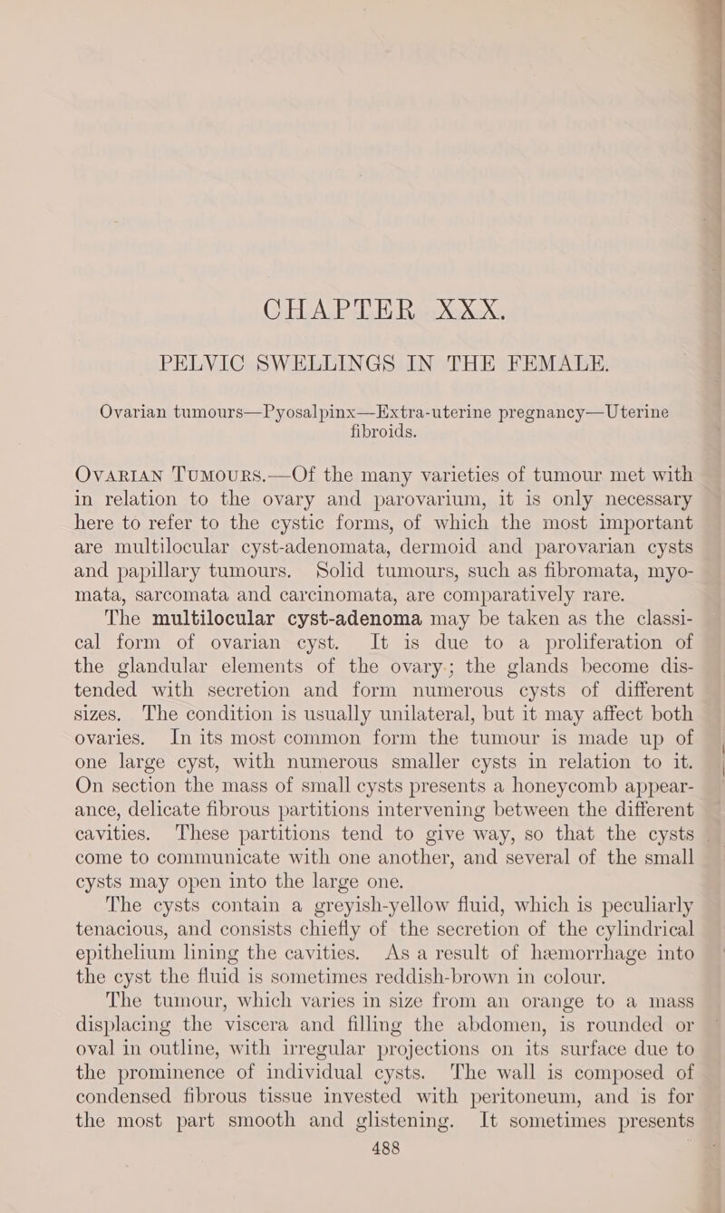 CHAPTER XXX. PELVIC SWELLINGS IN THE FEMALE. Ovarian tumours—Pyosalpinx—Extra-uterine pregnancy— Uterine fibroids. OvaRrIaAN Tumours.—Of the many varieties of tumour met with in relation to the ovary and parovarium, it is only necessary here to refer to the cystic forms, of which the most important are multilocular cyst-adenomata, dermoid and parovarian cysts and papillary tumours. Solid tumours, such as fibromata, myo- mata, sarcomata and carcinomata, are comparatively rare. The multilocular cyst-adenoma may be taken as the classi- cal form of ovarian cyst. It is due to a proliferation of the glandular elements of the ovary; the glands become dis- tended with secretion and form numerous cysts of different sizes. The condition is usually unilateral, but it may affect both ovaries. In its most common form the tumour is made up of one large cyst, with numerous smaller cysts in relation to it. On section the mass of small cysts presents a honeycomb appear- ance, delicate fibrous partitions intervening between the different cavities. These partitions tend to give way, so that the cysts come to communicate with one another, and several of the small cysts may open into the large one. The cysts contain a greyish-yellow fluid, which is peculiarly tenacious, and consists chiefly of the secretion of the cylindrical epithelium lining the cavities. Asa result of heemorrhage into the cyst the fluid is sometimes reddish-brown in colour. The tumour, which varies in size from an orange to a mass displacing the viscera and fillmg the abdomen, is rounded or oval in outline, with irregular projections on its surface due to the prominence of individual cysts. The wall is composed of condensed fibrous tissue invested with peritoneum, and is for the most part smooth and glistening. It sometimes presents