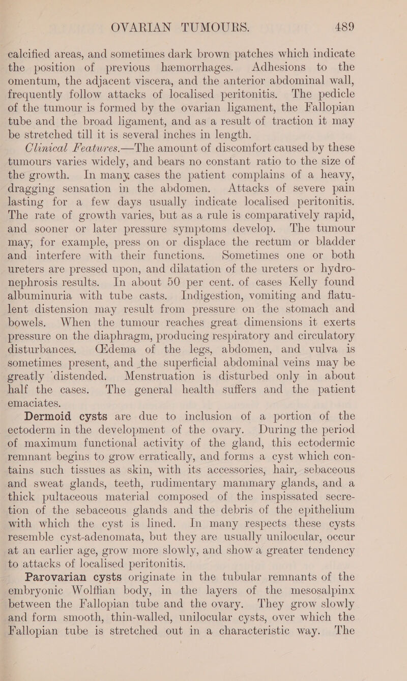 calcified areas, and sometimes dark brown patches which indicate the position of previous hemorrhages. Adhesions to the omentum, the adjacent viscera, and the anterior abdominal wall, frequently follow attacks of localised peritonitis. The pedicle of the tumour is formed by the ovarian ligament, the Fallopian tube and the broad ligament, and as a result of traction it may be stretched till it is several inches in length. Clinical Features.—The amount of discomfort caused by these tumours varies widely, and bears no constant ratio to the size of the growth. In many cases the patient complains of a heavy, dragging sensation in the abdomen. Attacks of severe pain lasting for a few days usually indicate localised peritonitis. The rate of growth varies, but as a rule is comparatively rapid, and sooner or later pressure symptoms develop. The tumour may, for example, press on or displace the rectum or bladder and interfere with their functions. Sometimes one or both ureters are pressed upon, and dilatation of the ureters or hydro- nephrosis results. In about 50 per cent. of cases Kelly found albuminuria with tube casts. Indigestion, vomiting and flatu- lent distension may result from pressure on the stomach and bowels. When the tumour reaches great dimensions it exerts pressure on the diaphragm, producing respiratory and circulatory disturbances. Cidema of the legs, abdomen, and vulva is sometimes present, and the superficial abdominal veins may be greatly ‘distended. Menstruation is disturbed only in about half the cases. The general health suffers and the patient emaciates. Dermoid cysts are due to inclusion of a portion of the ectoderm in the development of the ovary. During the period of maximum functional activity of the gland, this ectodermic remnant begins to grow erratically, and forms a cyst which con- tains such tissues as skin, with its accessories, hair, sebaceous and sweat glands, teeth, rudimentary mammary glands, and a thick pultaceous material composed of the inspissated secre- tion of the sebaceous glands and the debris of the epithelium with which the cyst is lined. In many respects these cysts resemble cyst-adenomata, but they are usually unilocular, occur at an earlier age, grow more slowly, and show a greater tendency to attacks of localised peritonitis. Parovarian cysts originate in the tubular remnants of the embryonic Wolffian body, in the layers of the mesosalpinx between the Fallopian tube and the ovary. They grow slowly and form smooth, thin-walled, unilocular cysts, over which the Fallopian tube is stretched out in a characteristic way. The