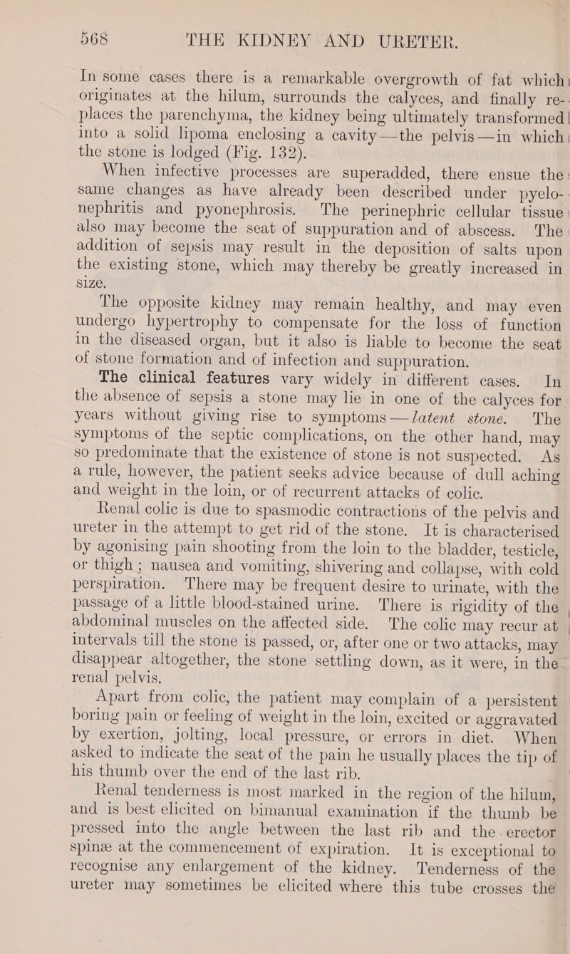 In some cases there is a remarkable overgrowth of fat which: originates at the hilum, surrounds the calyces, and finally re-- places the parenchyma, the kidney being ultimately transformed | into a solid lipoma enclosing a cavity—the pelvis—in which: the stone is lodged (Fig. 132). When infective processes are superadded, there ensue the: same changes as have already been described under pyelo-- nephritis and pyonephrosis. The perinephric cellular tissue. also may become the seat of suppuration and of abscess. The. addition of sepsis may result in the deposition of salts upon the existing stone, which may thereby be greatly increased in size. The opposite kidney may remain healthy, and may even undergo hypertrophy to compensate for the loss of function in the diseased organ, but it also is liable to become the seat of stone formation and of infection and suppuration. The clinical features vary widely in different cases. In the absence of sepsis a stone may lie in one of the calyces for years without giving rise to symptoms —Jatent stone. The symptoms of the septic complications, on the other hand, may so predominate that the existence of stone is not suspected. As a rule, however, the patient seeks advice because of dull aching and weight in the loin, or of recurrent attacks of colic. Renal colic is due to spasmodic contractions of the pelvis and ureter in the attempt to get rid of the stone. It is characterised by agonising pain shooting from the loin to the bladder, testicle, or thigh ; nausea and vomiting, shivering and collapse, with cold perspiration. There may be frequent desire to urinate, with the passage of a little blood-stained urine. There is rigidity of the abdominal muscles on the affected side. The colic may recur at intervals till the stone is passed, or, after one or two attacks, may disappear altogether, the stone settling down, as it were, in the renal pelvis. Apart from colic, the patient may complain of a persistent boring pain or feeling of weight in the loin, excited or aggravated by exertion, jolting, local pressure, or errors in diet. When asked to indicate the seat of the pain he usually places the tip of his thumb over the end of the last rib. Renal tenderness is most marked in the region of the hilum, and is best elicited on bimanual examination if the thumb be pressed into the angle between the last rib and the. erector spine at the commencement of expiration. It is exceptional to recognise any enlargement of the kidney. Tenderness of the ureter may sometimes be elicited where this tube crosses the