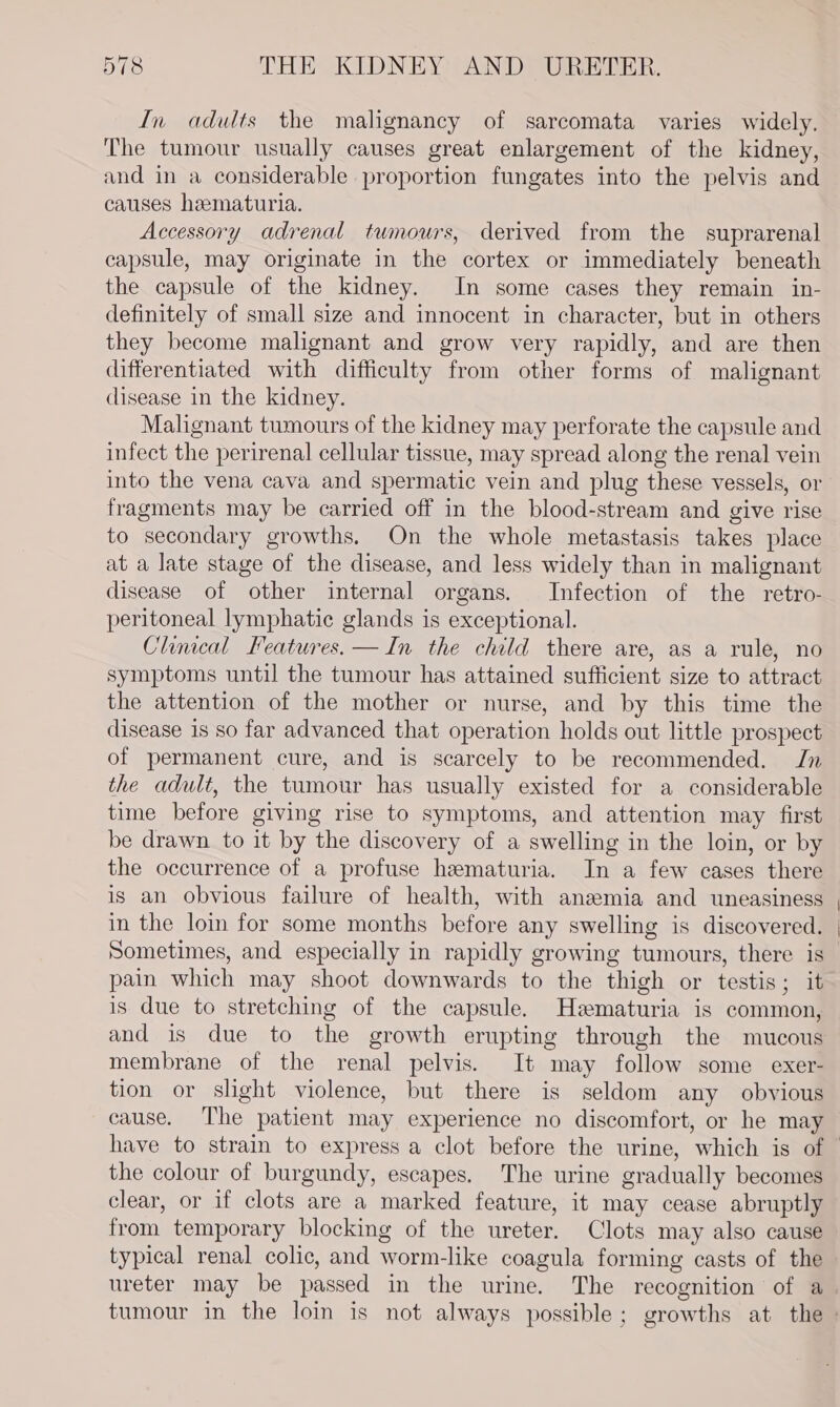 In adults the malignancy of sarcomata varies widely. The tumour usually causes great enlargement of the kidney, and in a considerable proportion fungates into the pelvis and causes hematuria. Accessory adrenal tumours, derived from the suprarenal capsule, may originate in the cortex or immediately beneath the capsule of the kidney. In some cases they remain in- definitely of small size and innocent in character, but in others they become malignant and grow very rapidly, and are then differentiated with difficulty from other forms of malignant disease in the kidney. Malignant tumours of the kidney may perforate the capsule and infect the perirenal cellular tissue, may spread along the renal vein into the vena cava and spermatic vein and plug these vessels, or fragments may be carried off in the blood-stream and give rise to secondary growths. On the whole metastasis takes place at a late stage of the disease, and less widely than in malignant disease of other internal organs. Infection of the retro- peritoneal lymphatic glands is exceptional. Chincal Features. —In the child there are, as a rule, no symptoms until the tumour has attained sufficient size to attract the attention of the mother or nurse, and by this time the disease 1s so far advanced that operation holds out little prospect of permanent cure, and is scarcely to be recommended. Jn the adult, the tumour has usually existed for a considerable time before giving rise to symptoms, and attention may first be drawn to it by the discovery of a swelling in the loin, or by the occurrence of a profuse hematuria. In a few cases there is an obvious failure of health, with anemia and uneasiness in the loin for some months before any swelling is discovered. Sometimes, and especially in rapidly growing tumours, there is pain which may shoot downwards to the thigh or testis; it is due to stretching of the capsule. Hzmaturia is common, and is due to the growth erupting through the mucous membrane of the renal pelvis. It may follow some exer- tion or slight violence, but there is seldom any obvious cause. The patient may experience no discomfort, or he may have to strain to express a clot before the urine, which is of the colour of burgundy, escapes. The urine gradually becomes clear, or if clots are a marked feature, it may cease abruptly from temporary blocking of the ureter. Clots may also cause typical renal colic, and worm-like coagula forming casts of the ureter may be passed in the urine. The recognition of a. tumour in the loin is not always possible; growths at the »