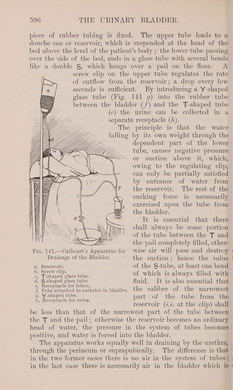 piece of rubber tubing is fixed. The upper tube leads to a douche can or reservoir, which is suspended at the head of the bed above the level of the patient’s body ; the lower tube passing over the side of the bed, ends in a glass tube with several bends like a double §, which hangs over a pail on the floor. &lt;A serew clip on the upper tube regulates the rate of outflow from the reservoir; a drop every few seconds is sufficient. By introducing a Y-shaped glass tube (Fig. 141 g) into the rubber tube between the bladder (f/f) and the T-shaped tube (c) the urine can be collected in a separate receptacle (/). The principle is that the water _ falling by its own weight through the dependent part of the “lower -. tube, causes negative pressure &lt;&lt;- or suction above it, which, owing to the regulating clip, can only be partially satisfied by entrance of water from the reservoir. The rest of the sucking force is necessarily exercised upon the tube from the bladder. It is essential that there shall always be some portion of the tube between the T and the pail completely filled, other- &lt;&lt; ‘9 Wize C- AX &gt; (li) SS QR ( Fia. 141.—Cathcart’s neo for wise air will pass and destroy | Drainage of the Bladder. the suction; hence the value | a, Reservoir, of the S-tube, at least one bend b, Screw clip. : os . : hea cae of which 1s always filled with d, S-shaped glass tube. fluid. It is also essential that e; Receptacle for lotion. : f, Tube attached to catheter in bladder. the calibre of the narrowest uf ieee ae nti part of the tube from the reservoir (7.e. at the clip) shall be less than that of the narrowest part of the tube between | the T and the pail; otherwise the reservoir becomes an ordinary head of water, the pressure in the system of tubes becomes | positive, and water is forced into the bladder. The apparatus works equally well in draining by the urethra, | through the perineum or suprapubically. The difference is that - in the two former cases there is no air in the system of tubes; - in the last case there is necessarily air in the bladder which is *