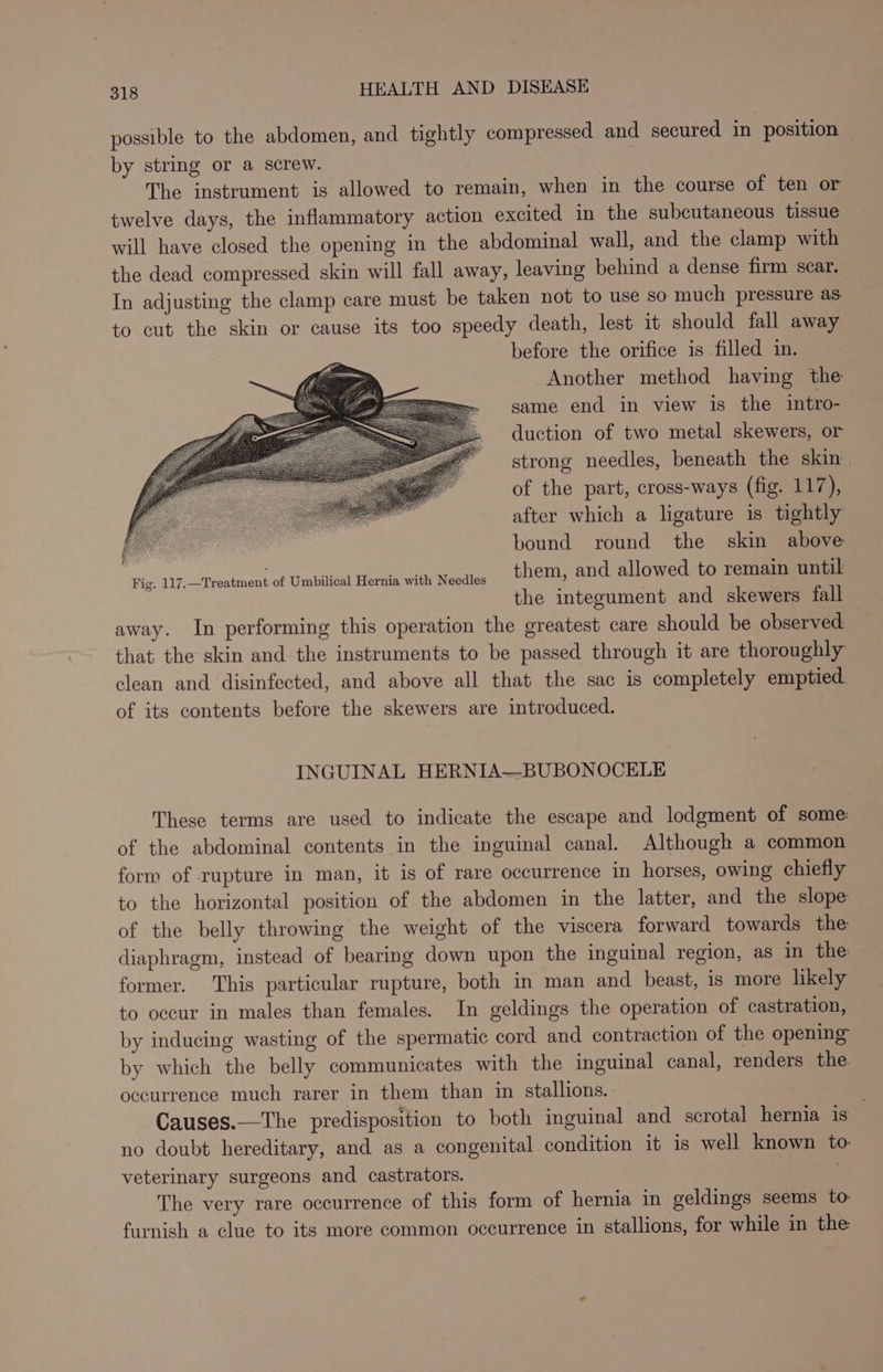 possible to the abdomen, and tightly compressed and secured in position — by string or a screw. The instrument is allowed to remain, when in the course of ten or twelve days, the inflammatory action excited in the subcutaneous tissue will have closed the opening in the abdominal wall, and the clamp with the dead compressed skin will fall away, leaving behind a dense firm scar. In adjusting the clamp care must be taken not to use so much pressure as to cut the skin or cause its too speedy death, lest it should fall away before the orifice is filled in. Another method having the same end in view is the intro- duction of two metal skewers, or strong needles, beneath the skin of the part, cross-ways (fig. 117), after which a ligature is tightly bound round the skin above them, and allowed to remain until the integument and skewers fall away. In performing this operation the greatest care should be observed that the skin and the instruments to be passed through it are thoroughly clean and disinfected, and above all that the sac is completely emptied of its contents before the skewers are introduced. INGUINAL HERNIA—BUBONOCELE These terms are used to indicate the escape and lodgment of some of the abdominal contents in the inguinal canal. Although a common form of rupture in man, it is of rare occurrence in horses, owing chiefly to the horizontal position of the abdomen in the latter, and the slope of the belly throwing the weight of the viscera forward towards the diaphragm, instead of bearing down upon the inguinal region, as in the former. This particular rupture, both in man and beast, is more likely to occur in males than females. In geldings the operation of castration, by inducing wasting of the spermatic cord and contraction of the opening by which the belly communicates with the inguinal canal, renders the. occurrence much rarer in them than in stallions. Causes.—The predisposition to both inguinal and scrotal hernia is no doubt hereditary, and as a congenital condition it is well known to: veterinary surgeons and castrators. The very rare occurrence of this form of hernia in geldings seems to furnish a clue to its more common occurrence in stallions, for while in the