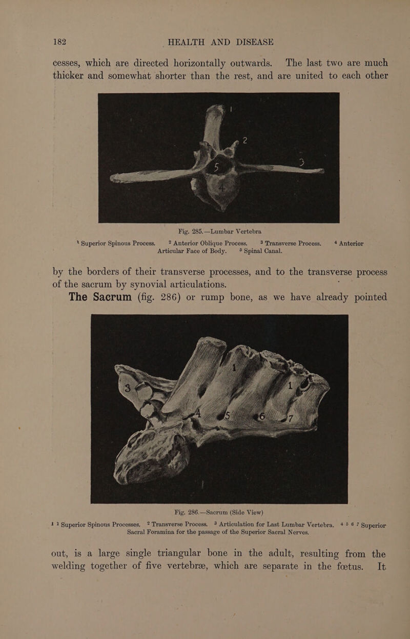 cesses, which are directed horizontally outwards. The last two are much thicker and somewhat shorter than the rest, and are united to each other Fig. 285.—Lumbar Vertebra ‘ Superior Spinous Process. 2 Anterior Oblique Process. 3 Transverse Process. 4 Anterior Articular Face of Body. 5 Spinal Canal. by the borders of their transverse processes, and to the transverse process of the sacrum by synovial articulations. The Sacrum (fig. 286) or rump bone, as we have already pointed 1 1 Superior Spinous Processes, ? Transverse Process. * Articulation for Last Lumbar Vertebra. 4 ® 6 7 Superior Sacral Foramina for the passage of the Superior Sacral Nerves. out, is a large single triangular bone in the adult, resulting from the welding together of five vertebre, which are separate in the fetus. It