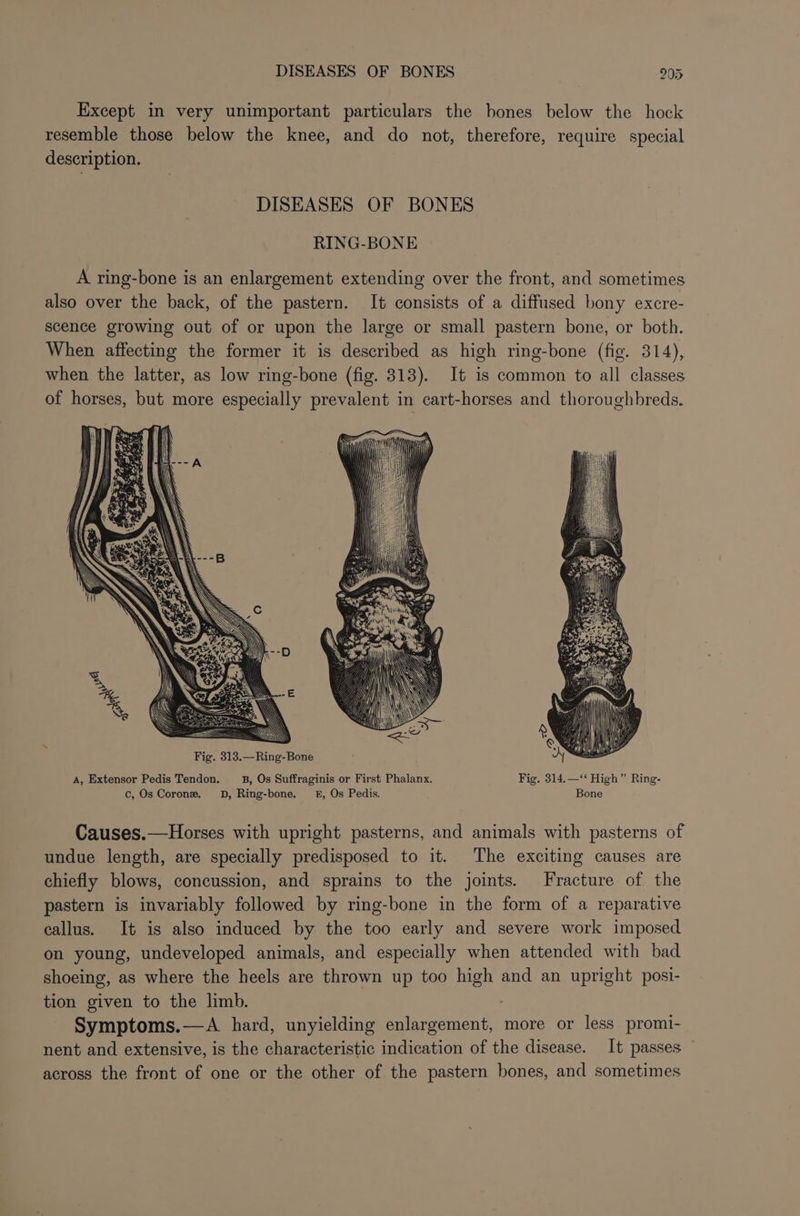 Except in very unimportant particulars the bones below the hock resemble those below the knee, and do not, therefore, require special description. DISEASES OF BONES RING-BONE A ring-bone is an enlargement extending over the front, and sometimes also over the back, of the pastern. It consists of a diffused bony excre- scence growing out of or upon the large or small pastern bone, or both. When affecting the former it is described as high ring-bone (fig. 314), when the latter, as low ring-bone (fig. 313). It is common to all classes of horses, but more especially prevalent in cart-horses and thoroughbreds. Fig. 313.—Ring-Bone A, Extensor Pedis Tendon. __ B, Os Suffraginis or First Phalanx. Fig. 314.—‘‘ High” Ring- c, Os Coroner, OD, Ring-bone. £, Os Pedis. Bone Causes.—Horses with upright pasterns, and animals with pasterns of undue length, are specially predisposed to it. The exciting causes are chiefly blows, concussion, and sprains to the joints. Fracture of the pastern is invariably followed by ring-bone in the form of a reparative callus. It is also induced by the too early and severe work imposed on young, undeveloped animals, and especially when attended with bad shoeing, as where the heels are thrown up too high and an upright posi- tion given to the limb. | Symptoms.—A hard, unyielding enlargement, more or less promi- nent and extensive, is the characteristic indication of the disease. It passes across the front of one or the other of the pastern bones, and sometimes