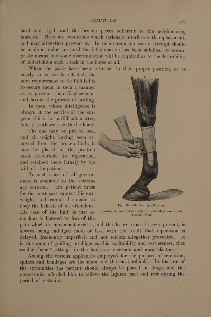 hard and rigid, and the broken pieces adherent to the neighbouring muscles. These are conditions which seriously interfere with replacement, and may altogether prevent it. In such circumstances no attempt should be made at reduction until the inflammation has been subdued by appro- priate means, and some discrimination will be required as to the desirability of undertaking such a task in the horse at all. _ When the parts have been returned to their proper position, or as nearly so as can be effected, the next requirement to be fulfilled is to secure them in such 'a manner as to prevent their displacement and favour the process of healing. In man, whose intelligence is always at the service of the sur- geon, this is not a difficult matter, but it is otherwise with the horse. The one may be put to bed, and all weight having been re- moved from the broken limb, it &amp; may be placed in the position most favourable to reparation, and retained there largely by the will of the patient. No such sense of self-govern- ment is available to the veterin- ary surgeon. His patient must for the most part support his own weight, and cannot be made to ona obey the behests of his attendant. Fig. 331.—Bandaging a Fore-leg His care/of the limb is just go Sherine tho wethod of applying the bandage over'a pad much as is dictated by fear of the pain which its movement excites, and the desire to use it, ever present, is always being indulged more or less, with the result that reparation is delayed, frequently imperfect, and not seldom altogether prevented. It is this want of guiding intelligence, this excitability and restlessness, that renders bone-“ setting” in the horse so uncertain and unsatisfactory. Among the various appliances employed for the purpose of retention, splints and bandages are the main and the most reliable. In fracture of the extremities the patient should always be placed in slings, and the opportunity afforded him to relieve the injured part and rest during the period of restraint.