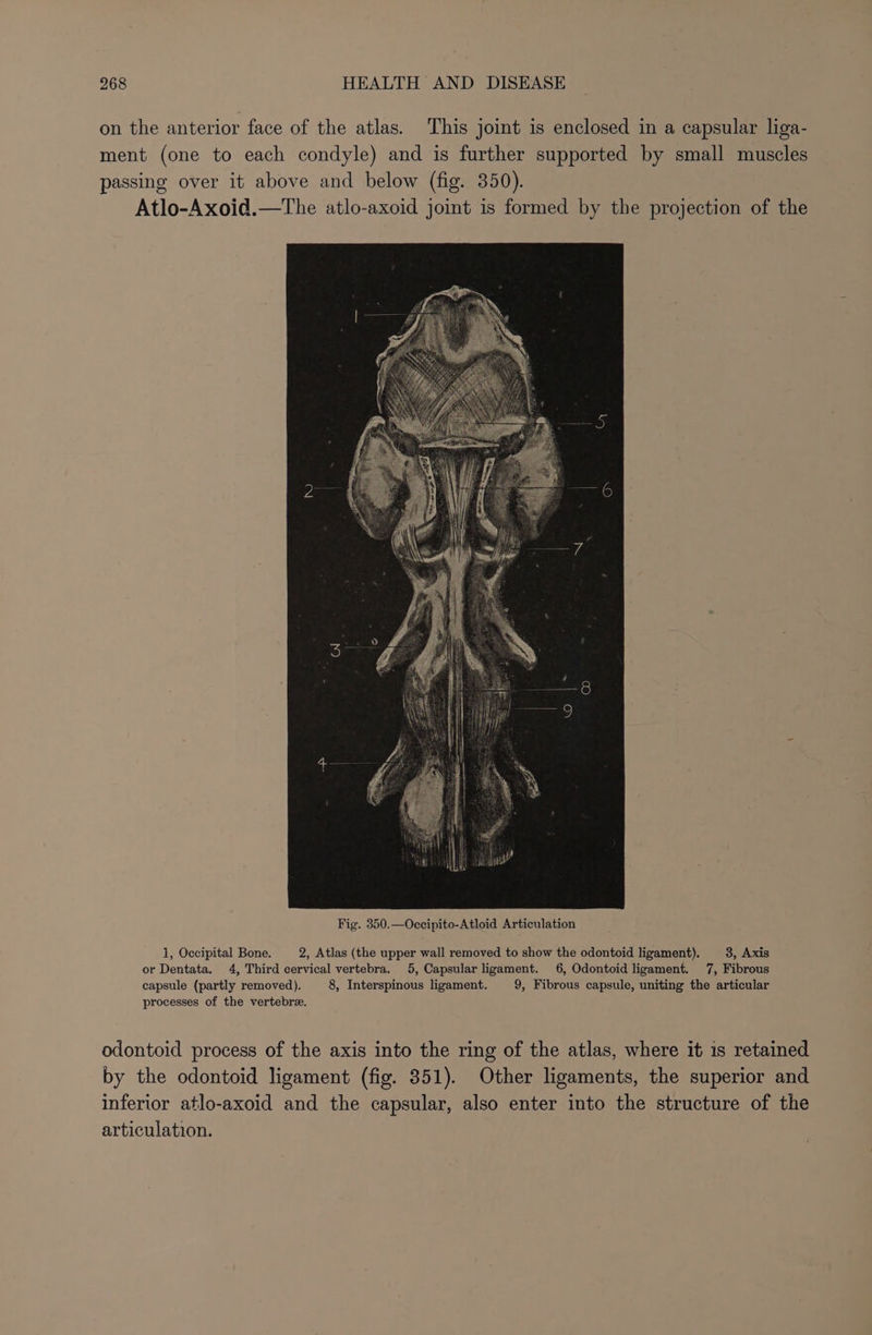 on the anterior face of the atlas. This joint is enclosed in a capsular liga- ment (one to each condyle) and is further supported by small muscles passing over it above and below (fig. 350). Atlo-Axoid.—The atlo-axoid joint is formed by the projection of the 1, Occipital Bone. 2, Atlas (the upper wall removed to show the odontoid ligament). 3, Axis or Dentata. 4, Third cervical vertebra. 5, Capsular ligament. 6, Odontoid ligament. 7, Fibrous capsule (partly removed). 8, Interspinous ligament. 9, Fibrous capsule, uniting the articular processes of the vertebre. odontoid process of the axis into the ring of the atlas, where it is retained by the odontoid ligament (fig. 351). Other ligaments, the superior and inferior atlo-axoid and the capsular, also enter into the structure of the articulation.