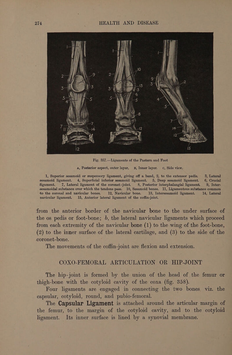 A, Posterior aspect, outer layer, 8B, Inner layer. 0, Side view. 1, Superior sesamoid or suspensory ligament, giving off a band, 2, to the extensor pedis. 3, Lateral sesamoid ligament. 4, Superficial inferior sesamoid ligament. 5, Deep sesamoid ligament. 6, Crucial ligament. 7, Lateral ligament of the coronet-joint. 8, Posterior interphalangial ligament. 9, Inter- ssesamoidal substance over which the tendons pass. 10, Sesamoid bones. 11, Ligamentous substance common to the coronal and navicular bones. 12, Navicular bone. 13, Intersesamoid ligament. 14, Lateral navicular ligament. 15, Anterior lateral ligament of the coffin-joint. from the anterior border of the navicular bone to the under surface of the os pedis or foot-bone; 6, the lateral navicular ligaments which proceed from each extremity of the navicular bone (1) to the wing of the foot-bone, (2) to the inner surface of the lateral cartilage, and (3) to the side of the coronet-bone. The movements of the coffin-joint are flexion and extension. COXO-FEMORAL ARTICULATION OR HIP-JOINT The hip-joint is formed by the union of the head of the femur or thigh-bone with the cotyloid cavity of the coxa (fig. 358). Four ligaments are engaged in connecting the two bones. viz. the capsular, cotyloid, round, and pubio-femoral. The Capsular Ligament is attached around the articular margin of the femur, to the margin of the cotyloid cavity, and to the cotyloid ligament. Its inner surface is lined by a synovial membrane.