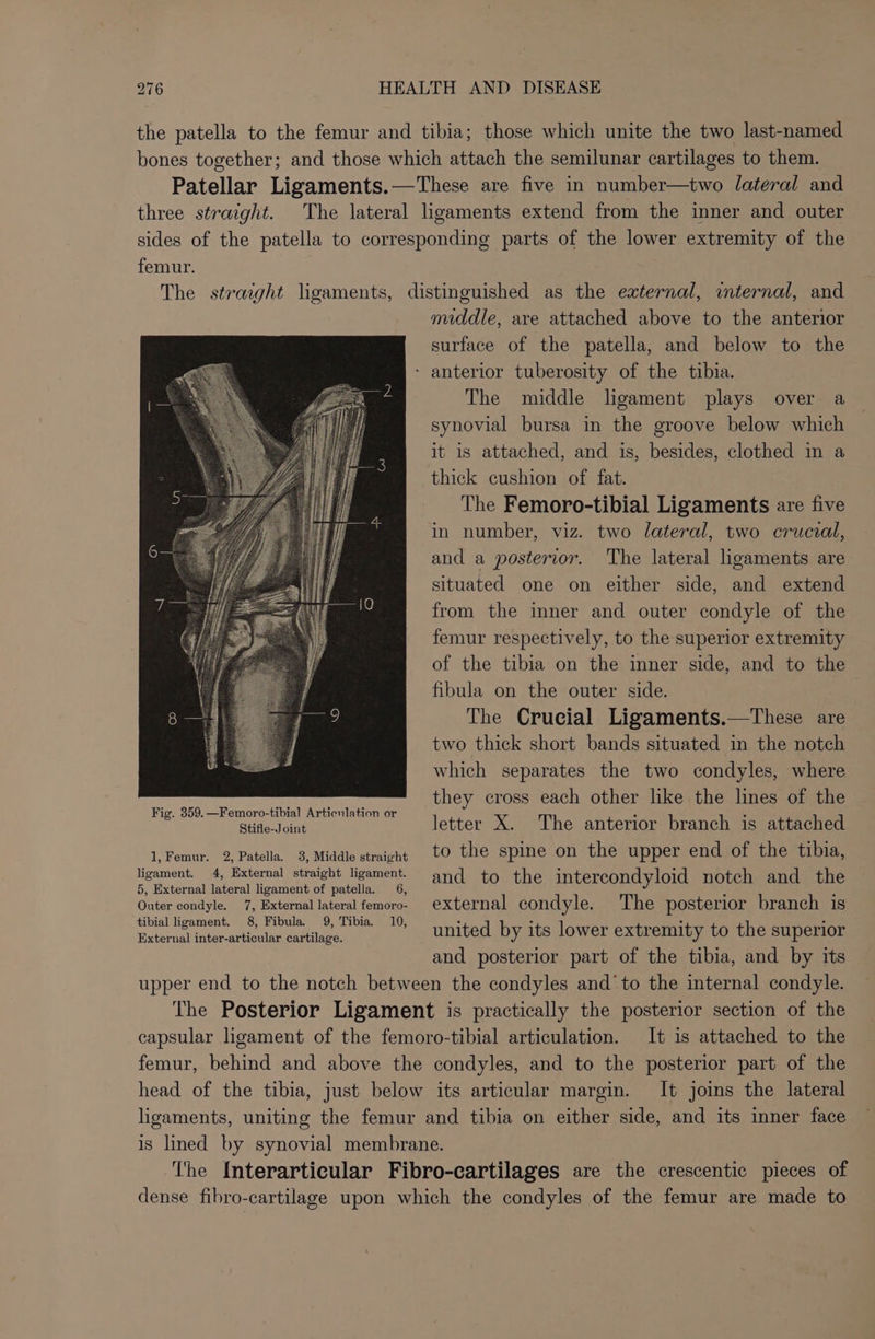 the patella to the femur and tibia; those which unite the two last-named bones together; and those which attach the semilunar cartilages to them. Patellar Ligaments.—These are five in number—two lateral and three straight. The lateral ligaments extend from the inner and outer sides of the patella to corresponding parts of the lower extremity of the femur. The straight ligaments, distinguished as the external, internal, and middle, are attached above to the anterior surface of the patella, and below to the - anterior tuberosity of the tibia. The middle ligament plays over a synovial bursa in the groove below which it is attached, and is, besides, clothed in a thick cushion of fat. The Femoro-tibial Ligaments are five in number, viz. two lateral, two crucial, and a posterior. The lateral ligaments are situated one on either side, and extend from the inner and outer condyle of the femur respectively, to the superior extremity of the tibia on the inner side, and to the fibula on the outer side. The Crucial Ligaments.—These are two thick short bands situated in the notch which separates the two condyles, where they cross each other like the lines of the tibial ligament. 8, Fibula. 9, Tibia. 10, Jixternatiieos anemia, united by its lower extremity to the superior and posterior part of the tibia, and by its upper end to the notch between the condyles and ‘to the internal condyle. The Posterior Ligament is practically the posterior section of the capsular ligament of the femoro-tibial articulation. It is attached to the femur, behind and above the condyles, and to the posterior part of the head of the tibia, just below its articular margin. It joins the lateral ligaments, uniting the femur and tibia on either side, and its inner face is lined by synovial membrane. ‘The Interarticular Fibro-cartilages are the crescentic pieces of dense fibro-cartilage upon which the condyles of the femur are made to