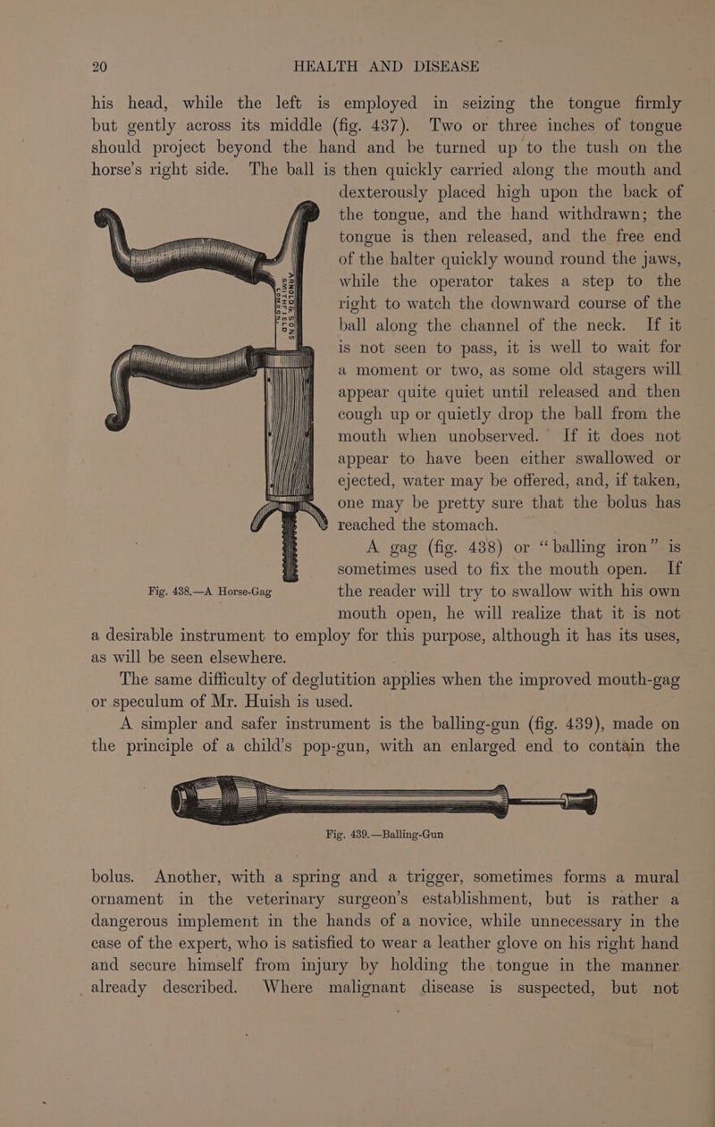 his head, while the left is employed in seizing the tongue firmly but gently across its middle (fig. 437). Two or three inches of tongue should project beyond the hand and be turned up to the tush on the horse’s right side. The ball is then quickly carried along the mouth and dexterously placed high upon the back of the tongue, and the hand withdrawn; the tongue is then released, and the free end of the halter quickly wound round the jaws, while the operator takes a step to the right to watch the downward course of the ball along the channel of the neck. [If it is not seen to pass, it is well to wait for a moment or two, as some old stagers will appear quite quiet until released and then cough up or quietly drop the ball from the mouth when unobserved. If it does not appear to have been either swallowed or ejected, water may be offered, and, if taken, one may be pretty sure that the bolus has » reached the stomach. A gag (fig. 438) or “balling iron” is sometimes used to fix the mouth open. If Fig. 438.—A Horse-Gag the reader will try to swallow with his own | mouth open, he will realize that it is not a desirable instrument to employ for this purpose, although it has its uses, as will be seen elsewhere. The same difficulty of deglutition applies when the improved mouth-gag or speculum of Mr. Huish is used. A simpler and safer instrument is the balling-gun (fig. 439), made on the principle of a child’s pop-gun, with an enlarged end to contain the ag13143HiLIWS SNOS 9 0TONUV il bolus. Another, with a spring and a trigger, sometimes forms a mural ornament in the veterinary surgeon’s establishment, but is rather a dangerous implement in the hands of a novice, while unnecessary in the case of the expert, who is satisfied to wear a leather glove on his right hand and secure himself from injury by holding the, tongue in the manner already described. Where malignant disease is suspected, but not