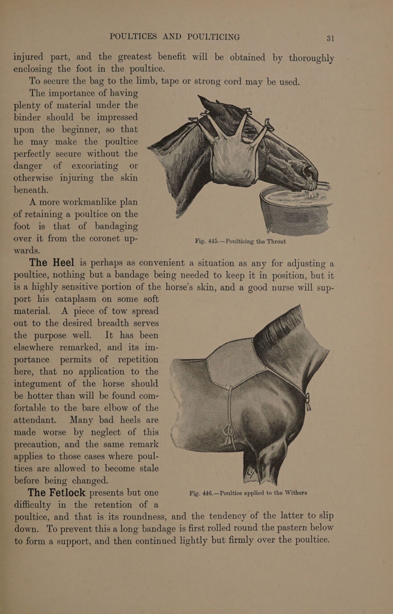 injured part, and the greatest benefit will be obtained by thoroughly enclosing the foot in the poultice. To secure the bag to the limb, tape or strong cord may be used. The importance of having plenty of material under the upon the beginner, so that he may make the poultice perfectly secure without the danger of excoriating or otherwise injuring the skin beneath. A more workmanlike plan foot is that of bandaging over it from the coronet up- Fig. 445.—Poulticing the Throat wards. The Heel is perhaps as convenient a situation as any for adjusting a poultice, nothing but a bandage being needed to keep it in position, but it is a highly sensitive portion of the horse’s skin, and a good nurse will sup- port his cataplasm on some soft material. A piece of tow spread out to the desired breadth serves the purpose well. It has been elsewhere remarked, and its im- portance permits of repetition here, that no application to the integument of the horse should be hotter than will be found com- fortable to the bare elbow of the made worse by neglect of this precaution, and the same remark applies to those cases where poul- tices are allowed to become stale before being changed. The Fetlock presents but one Fig. 446.—Poultice applied to the Withers difficulty in the retention of a poultice, and that is its roundness, and the tendency of the latter to slip down. To prevent this a long bandage is first rolled round the pastern below to form a support, and then continued lightly but firmly over the poultice.