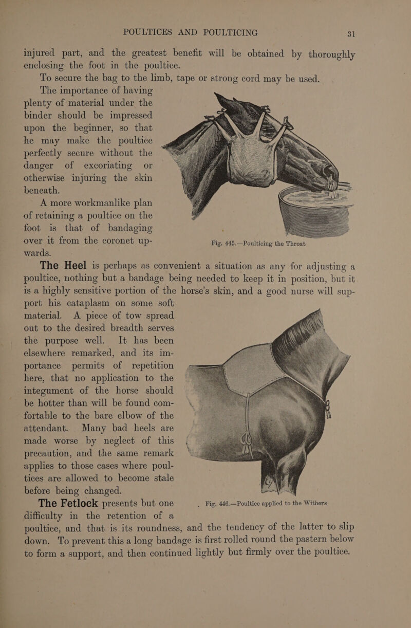 injured part, and the greatest benefit will be obtained by thoroughly enclosing the foot in the poultice. To secure the bag to the limb, tape or strong cord may be used. The importance of having plenty of material under the binder should be impressed upon the beginner, so that he may make the poultice perfectly secure without the danger of excoriating or otherwise injuring the skin beneath. A more workmanlike plan of retaining a poultice on the foot is that of bandaging over it from the coronet up- Fig, 445.—Poulticing the Throat wards. The Heel is perhaps as convenient a situation as any for adjusting a poultice, nothing but a bandage being needed to keep it in position, but it is a highly sensitive portion of the horse’s skin, and a good nurse will sup- port his cataplasm on some soft material. A piece of tow spread out to the desired breadth serves the purpose well. It has been elsewhere remarked, and its im- portance permits of repetition here, that no application to the integument of the horse should be hotter than will be found com- fortable to the bare elbow of the attendant. Many bad heels are made worse by neglect of this precaution, and the same remark applies to those cases where poul- tices are allowed to become stale before being changed. : on The Fetlock presents but one _ Fig. 446.—Poultice applied to the Withers difficulty in the retention of a poultice, and that is its roundness, and the tendency of the latter to slip down. To prevent this a long bandage is first rolled round the pastern below to form a support, and then continued lightly but firmly over the poultice.