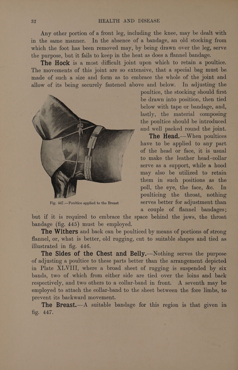 Any other portion of a front leg, including the knee, may be dealt with in the same manner. In the absence of a bandage, an old stocking from which the foot has been removed may, by being drawn over the leg, serve the purpose, but it fails to keep in the heat as does a flannel bandage. The Hock is a most difficult joint upon which to retain a poultice. The movements of this joint are so extensive, that a special bag must be made of such a size and form as to embrace the whole of the jomt and allow of its being securely fastened above and below. In adjusting the poultice, the stocking should first be drawn into position, then tied below with tape or bandage, and, lastly, the material composing the poultice should be introduced and well packed round the joint. The Head.—When poultices have to be applied to any part of the head or face, it is usual to make the leather head-collar serve as a support, while a hood may also be utilized to retain them in such positions as the poll, the eye, the face, &amp;c. In A poulticing the throat, nothing Fig. 447.—Poultice applied to the Breast serves better for adjustment than a couple of flannel bandages; but if it is required to embrace the space behind the jaws, the throat. bandage (fig. 445) must be employed. The Withers and back can be poulticed by means of portions of strong flannel, or, what is better, old rugging, cut to suitable shapes and tied as. illustrated in fig. 446. The Sides of the Chest and Belly.—Nothing serves the purpose: of adjusting a poultice to these parts better than the arrangement depicted in Plate XLVIII, where a broad sheet of rugging is suspended by six bands, two of which from either side are tied over the loins and back respectively, and two others to a collar-band in front. A seventh may be employed to attach the collar-band to the sheet between the fore limbs, to prevent its backward movement. The Breast.—A suitable bandage for this region is that given in fig. 447.