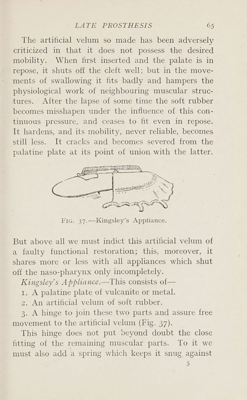 The artificial velum so made has been adversely criticized in that it does not possess the desired mobility. When first inserted and the palate is in repose, it shuts off the cleft well; but in the move- ments of swallowing it fits badly and hampers the physiological work of neighbouring muscular struc- tures. After the lapse of some time the soft rubber becomes misshapen under the influence of this con- tinuous pressure, and ceases to fit even in repose. It hardens, and its mobility, never reliable, becomes still less. It cracks and becomes severed from the palatine plate at its point of union with the latter. Fic. 37.—Kingsley’s Appliance. But above all we must indict this artificial velum of a faulty functional restoration; this, moreover, it shares more or less with all appliances which shut off the naso-pharynx only incompletely. Kingsley’s Appliance.—This consists of— . A palatine plate of vulcanite or metal. . An artificial velum of soft rubber. . A hinge to join these two parts and assure free movement to the artificial velum (Fig. 37). This hinge does not put beyond doubt the close fitting of the remaining muscular parts. To it we must also add a spring which keeps it snug against -) Com