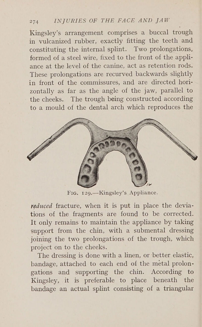 Kingsley’s arrangement comprises a buccal trough in vulcanized rubber, exactly fitting the teeth and constituting the internal splint. Two prolongations, formed of a steel wire, fixed to the front of the appl- ance at the level of the canine, act as retention rods. These prolongations are recurved backwards slightly in front of the commissures, and are directed hori- zontally as far as the angle of the jaw, parallel to the cheeks. The trough being constructed according to a mould of the dental arch which reproduces the veduced fracture, when it is put in place the devia- tions of the fragments are found to be corrected. It only remains to maintain the appliance by taking support from the chin, with a submental dressing joining the two prolongations of the trough, which project on to the cheeks. The dressing is done with a linen, or better elastic, bandage, attached to each end of the metal prolon- gations and supporting the chin. According to Kingsley, it is preferable to place beneath the bandage an actual splint consisting of a triangular