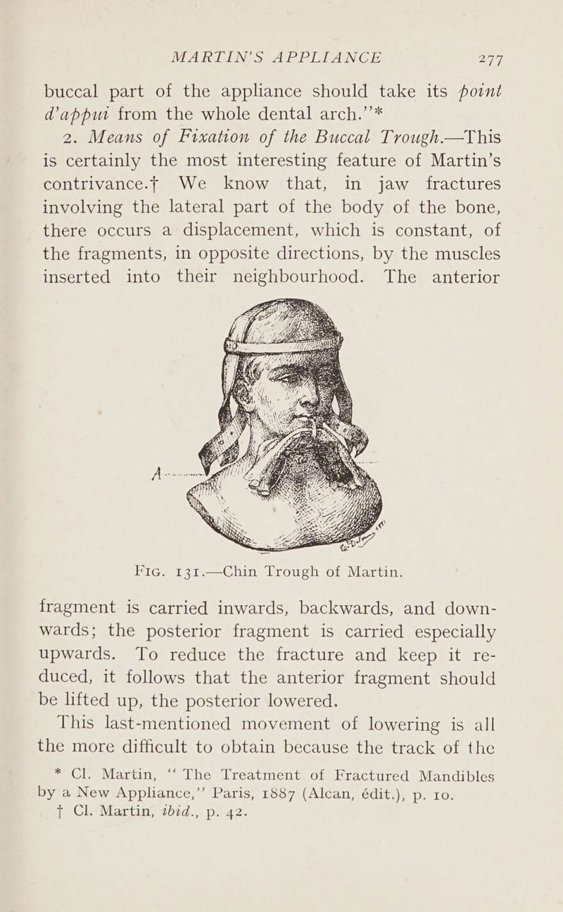 buccal part of the appliance should take its point dappu from the whole dental arch.’’* 2. Means of Fixation of the Buccal Trough.—This is certainly the most interesting feature of Martin’s contrivance.t We know that, in jaw fractures involving the lateral part of the body of the bone, there occurs a displacement, which is constant, of the fragments, in opposite directions, by the muscles inserted into their neighbourhood. The anterior Pic. 131.—Chin Trough of Martin. fragment is carried inwards, backwards, and down- wards; the posterior fragment is carried especially upwards. To reduce the fracture and keep it re- duced, it follows that the anterior fragment should be lifted up, the posterior lowered. This last-mentioned movement of lowering is all the more difficult to obtain because the track of the * Cl. Martin, ‘‘ The Treatment of Fractured Mandibles by a New Appliance,’’ Paris, 1887 (Alcan, édit.), p. ro. {| Cl. Martin, tbid., p. 42.