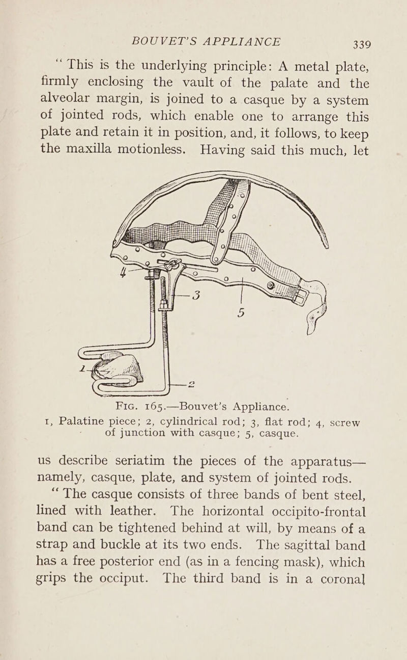 “ This is the underlying principle: A metal plate, firmly enclosing the vault of the palate and the alveolar margin, is joined to a casque by a system of jointed rods, which enable one to arrange this plate and retain it in position, and, it follows, to keep the maxilla motionless. Having said this much, let us describe seriatim the pieces of the apparatus— namely, casque, plate, and system of jointed rods. “The casque consists of three bands of bent steel, lined with leather. The horizontal occipito-frontal band can be tightened behind at will, by means of a strap and buckle at its two ends. The sagittal band has a free posterior end (as in a fencing mask), which grips the occiput. The third band is in a coronal