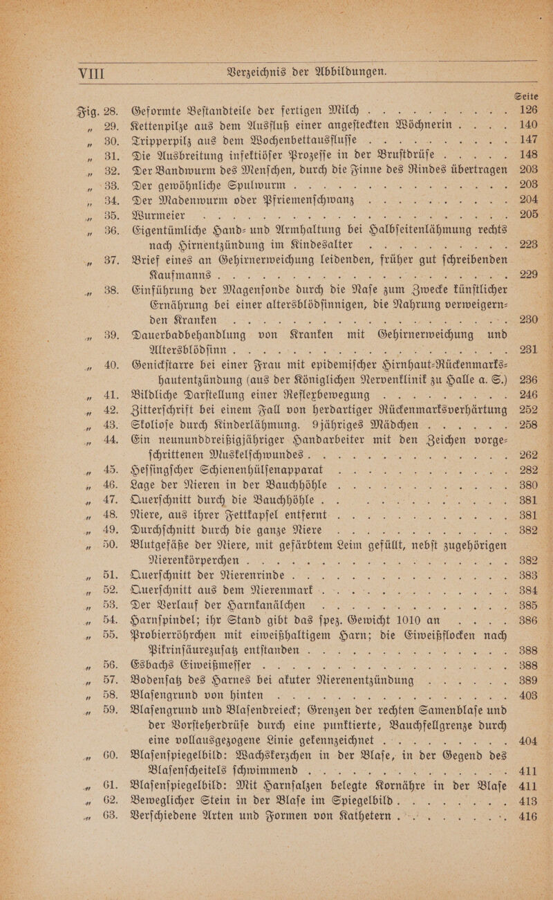 Verzeichnis der Abbildungen. N Geformte Beſtandteile der fertigen Milch . N Kettenpilze aus dem Ausfluß einer angeſteckten Wöchnerin 5 Tripperpilz aus dem Wochenbettausfluſſe 8 Die Ausbreitung infektiöſer Prozeſſe in der Bruftprlfe Der Bandwurm des Menſchen, durch die Finne des a äbertragen Der gewöhnliche Spulwurm . VVV Der Madenwurm oder Pfriemenſchwanz Wurmeier Eigentümliche Hand⸗ au rmhaltung bi Halbſeitenlähmung rechts nach Hirnentzündung im Kindesalter Brief eines an Gehirnerweichung leidenden, früher a brechen Kaufmanns Einführung der Magen onde durch Bi Naſe zum Zwecke tünſtlicher Ernährung bei einer „„ die Nahrung e den Kranken i Dauerbadbehandlung von „„ m „„ 5 Altersblödfinn . i Genickſtarre bei einer Frau ik ei Hirnhaut⸗ e hautentzündung (aus der Königlichen Nervenklinik zu Halle a. S.) Bildliche Darſtellung einer Reflexbewegung 0 Zitterſchrift bei einem Fall von herdartiger Nen Skolioſe durch Kinderlähmung. 9 jähriges Mädchen. Ein neununddreißigjähriger Handarbeiter mit den Zeichen a ſchrittenen Muskelſchwundes. i BE Heſſingſcher Schienenhülſenapparat Lage der Nieren in der Bauchhöhle Querſchnitt durch die Bauchhöhle. Niere, aus ihrer Fettkapſel entfernt Durchſchnitt durch die ganze Niere 5 Blutgefäße der Niere, mit A Leim oefät, ve sugehdeigen Nierenkörperchen . 3 Querſchnitt der Nierenrinde . Querſchnitt aus dem Nierenmarf .. Der Verlauf der Harnkanälchen ge) Harnſpindel; ihr Stand gibt das ſpez. Gewicht 1010 c an Probierröhrchen mit eiweißhaltigem Harn; die Eiweißflocken nach Pikrinſäurezuſatz entſtanden . i en Esbachs Eiweißmeſſer Bodenſatz des Harnes bei akuter eren Blaſengrund von hinten Blaſengrund und Blaſendreieck; 9 der rechten Samenblaſe und der Vorſteherdrüſe durch eine punktierte, Bauchfellgrenze durch eine vollausgezogene Linie gekennzeichnet .. Blaſenſpiegelbild: Wachskerzchen in der Maaſe; in der enend des Blaſenſcheitels ſchwimmend 8 Blaſenſpiegelbild: Mit Harnſalzen belegte Kornähre in der dla Beweglicher Stein in der Blaſe im Spiegelbild. SEN h Verſchiedene Arten und Formen von Kathetern. 229 230 281 236 246 252 258 262 282 380 381 381 382 384 . 386 388 388 389 403 404 411 411 413 416