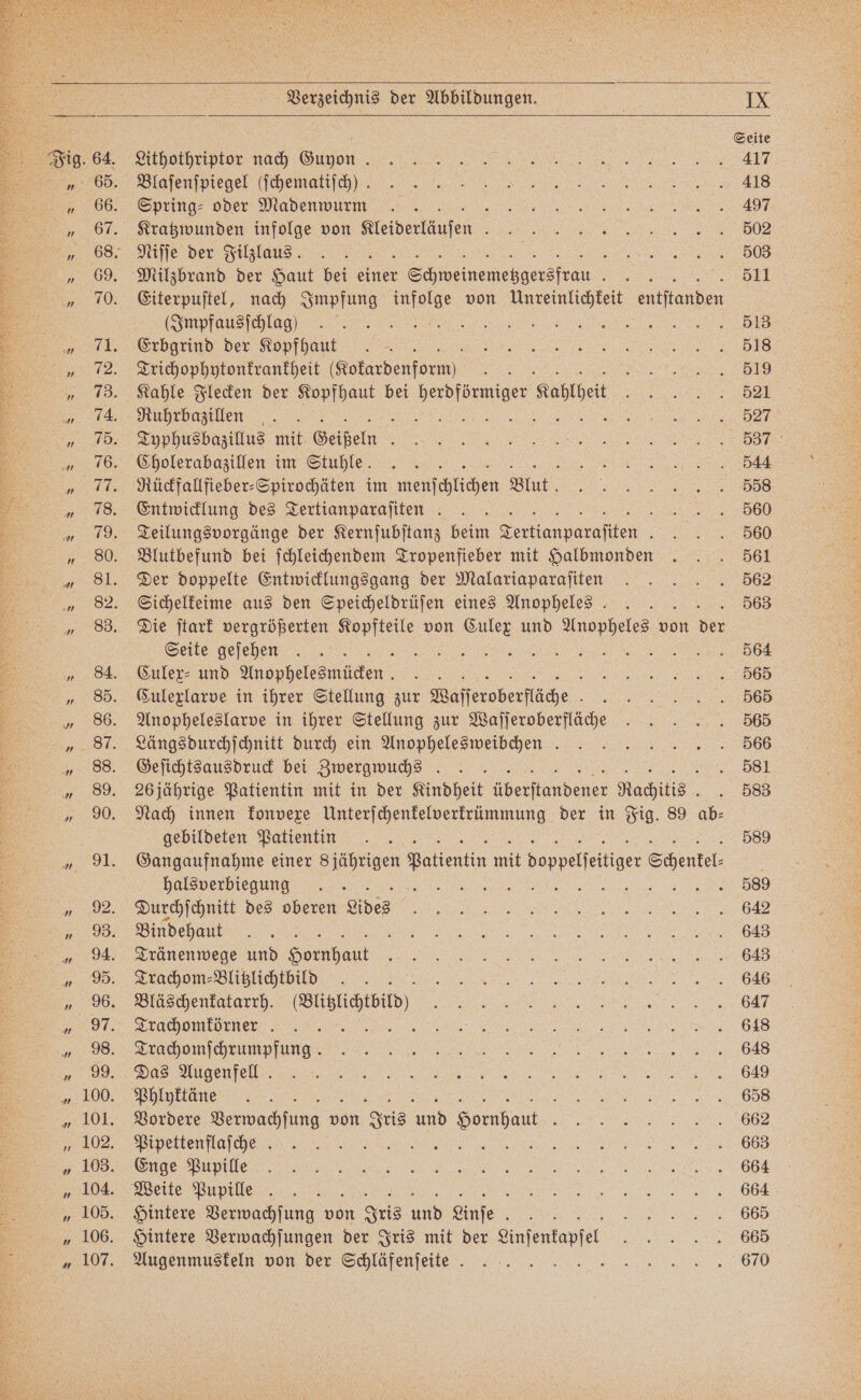 | Seite Stihpthriptor nach n sĩxĩi? e Mlafenſiezel ſchengiſdddde 18 Spring⸗ oder Madenwum . JJ A Kratzwunden infolge von Bteiertäufen VVV „Niſſe der Filzlaus VVV Milzbrand der Haut bei einer Sch egen . 511 Eiterpuſtel, nach Impfung infolge von Unreinlichkeit entſtanden ie . ee Bl Erbgrind der Kopfhaut J DR ce so 1 Trichophytonkrankheit (Kokardenform) RR e si) Kahle Flecken der Kopfhaut bei a, Kanther F Ruhrbazillen 8 „%%% Typhusbazillus mit Geißel JJ. Cholerabazillen im Stuhle 5 ͤ òùðͤLͥ I Rückfallfieber⸗Spirochäten im menſchtichen Blut. VVV Entwicklung des Tertianparaſiten i Teilungsvorgänge der Kernſubſtanz beim „„ „ Blutbefund bei ſchleichendem Tropenfieber mit Halbmonden . . . 561 Der doppelte Entwicklungsgang der Malariaparaſiten . 562 Sichelkeime aus den Speicheldrüſen eines Anopheles 563 Die ſtark vergrößerten a von wa und e von der Seite gefehen 5 . 5 564 Culex⸗ und op hel den 8 a Kt 2008 Culexlarve in ihrer Stellung zur Waſſeroberſläche HVV Anopheleslarve in ihrer Stellung zur Waſſer oberfläche: . 565 Längsdurchſchnitt durch ein Anopheles weibchen . 566 Geſichtsausdruck bei Zwergwuchs . 581 26 jährige Patientin mit in der Kindheit eee Rachitis 583 Nach innen konvexe Unterſchenkelverkrümmung der in Fig. 89 ab⸗ gebildeten Patientin 589 Gangaufnahme einer Sjährigen 1 mit Sappelieitiner Schenkel⸗ 19 85 halsverbiegung . )) en ae De nd Durchſchnitt des oberen Lides JJ SER le 2 ar BAD Bindehaut ae )))) EN Tränenwege und Hornhaut BEREIT NER SELL EEE aan a Need Bläschenkatarrh. Btisitsie) i ee ee A Trachomkörner %%% Re EEE ÄDERTE R b, hh uns. 648 %% V ß ĩ d e e oon Phlykkäne F3%%;ũ᷑ nn! rn IE Vordere Verwachſung von Iris und Hornhaut %) ea,, eie EF! / ß Weile Pupille ))VVVVVVVVVV ENG Hintere Verwachſung von Iris un 1 5 e VVV Hintere Verwachſungen der Iris mit der Cinfentape e Augenmuskeln von der Schläfenſeitte 35,» ᷑ -=