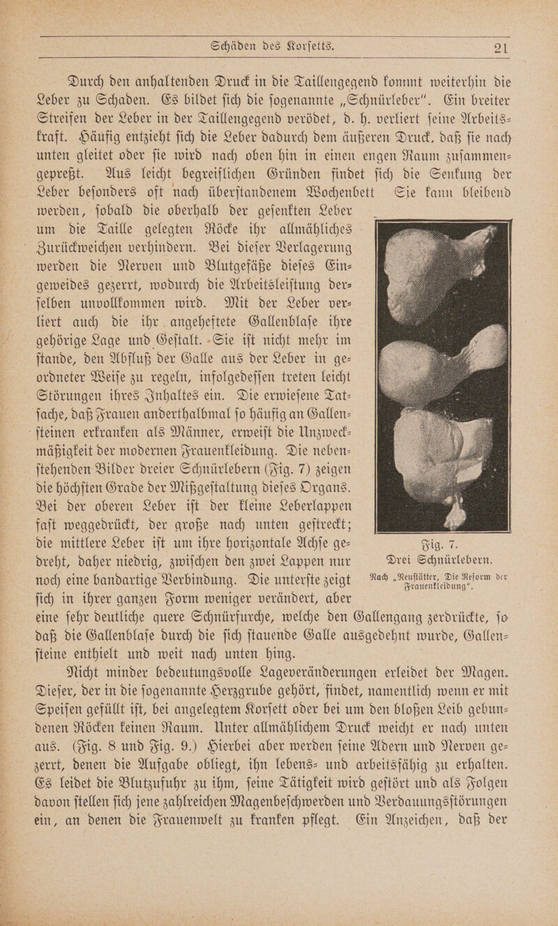 Durch den anhaltenden Druck in die Taillengegend kommt weiterhin die Leber zu Schaden. Es bildet ſich die ſogenannte „Schnürleber“. Ein breiter Streifen der Leber in der Taillengegend verödet, d. h. verliert ſeine Arbeits— kraft. Häufig entzieht ſich die Leber dadurch dem äußeren Druck, daß ſie nach unten gleitet oder ſie wird nach oben hin in einen engen Raum zuſammen— gepreßt. Aus leicht begreiflichen Gründen findet ſich die Senkung der Leber beſonders oft nach überſtandenem Wochenbett Sie kann bleibend werden, ſobald die oberhalb der geſenkten Leber um die Taille gelegten Röcke ihr allmähliches Zurückweichen verhindern. Bei dieſer Verlagerung werden die Nerven und Blutgefäße dieſes Ein⸗ geweides gezerrt, wodurch die Arbeitsleiſtung der— ſelben unvollkommen wird. Mit der Leber ver— liert auch die ihr angeheftete Gallenblaſe ihre gehörige Lage und Geſtalt. Sie iſt nicht mehr im ſtande, den Abfluß der Galle aus der Leber in ge— ordneter Weiſe zu regeln, infolgedeſſen treten leicht Störungen ihres Inhaltes ein. Die erwieſene Tat- ſache, daß Frauen anderthalbmal ſo häufig an Gallen— ſteinen erkranken als Männer, erweiſt die Unzweck— mäßigkeit der modernen Frauenkleidung. Die neben— ſtehenden Bilder dreier Schnürlebern (Fig. 7) zeigen die höchſten Grade der Mißgeſtaltung dieſes Organs. Bei der oberen Leber iſt der kleine Leberlappen faſt weggedrückt, der große nach unten geſtreckt; die mittlere Leber iſt um ihre horizontale Achſe ge— Fig. 7. dreht, daher niedrig, zwiſchen den zwei Lappen nur Drei Schnürlebern. noch eine bandartige Verbindung. Die unterſte zeigt Nac „A ot ſich in ihrer ganzen Form weniger verändert, aber eine ſehr deutliche quere Schnürfurche, welche den Gallengang zerdrückte, ſo daß die Gallenblaſe durch die ſich ſtauende Galle ausgedehnt wurde, Gallen— ſteine enthielt und weit nach unten hing. Nicht minder bedeutungsvolle Lageveränderungen erleidet der Magen. Dieſer, der in die ſogenannte Herzgrube gehört, findet, namentlich wenn er mit Speiſen gefüllt iſt, bei angelegtem Korſett oder bei um den bloßen Leib gebun— denen Röcken keinen Raum. Unter allmählichem Druck weicht er nach unten aus. (Fig. 8 und Fig. 9.) Hierbei aber werden ſeine Adern und Nerven ge— zerrt, denen die Aufgabe obliegt, ihn lebens- und arbeitsfähig zu erhalten. Es leidet die Blutzufuhr zu ihm, ſeine Tätigkeit wird geſtört und als Folgen davon ſtellen ſich jene zahlreichen Magenbeſchwerden und Verdauungsſtörungen ein, an denen die Frauenwelt zu kranken pflegt. Ein Anzeichen, daß der —