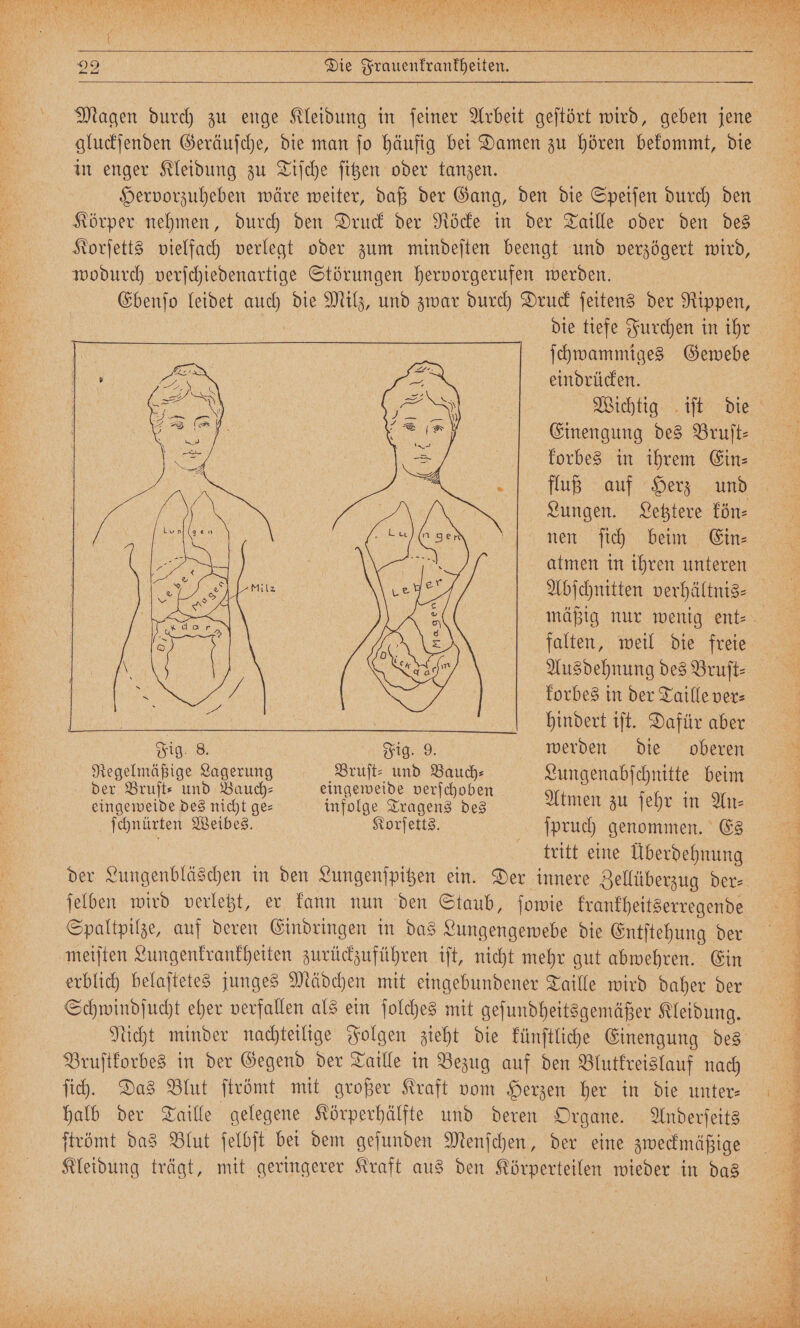 Magen durch zu enge Kleidung in ſeiner Arbeit geſtört wird, geben jene gluckſenden Geräuſche, die man ſo häufig bei Damen zu hören bekommt, die in enger Kleidung zu Tiſche ſitzen oder tanzen. Hervorzuheben wäre weiter, daß der Gang, den die Speiſen durch den Körper nehmen, durch den Druck der Röcke in der Taille oder den des Korſetts vielfach verlegt oder zum mindeſten beengt und verzögert wird, wodurch verſchiedenartige Störungen hervorgerufen werden. Ebenſo leidet 9 0 die Milz, und zwar durch Druck ſeitens der Rippen, ſchwammiges Gewebe eindrücken. Einengung des Bruſt⸗ korbes in ihrem Ein⸗ fluß auf Herz und Lungen. Letztere kön⸗ nen ſich beim Ein⸗ atmen in ihren unteren mäßig nur wenig ent⸗ falten, weil die freie Ausdehnung des Bruſt⸗ korbes in der Taille ver⸗ hindert iſt. Dafür aber Fig. 8. Fig. 9. werden die oberen ah 5 Hach Bruſt⸗ N 1 Lungenabſchnitte beim der Bruſt⸗ und Bauch eingeweide verſchoben 5 eingeweide des nicht ge— infolge Tragens des Atmen zu ſehr in An⸗ ſchnürten Weibes. Korſetts. ſpruch genommen. Es tritt eine Überdehnung der Lungenbläschen in den Lungenſpitzen ein. Der innere Zellüberzug der⸗ ſelben wird verletzt, er kann nun den Staub, ſowie krankheitserregende Spaltpilze, auf deren Eindringen in das ingengomähr die Entſtehung der meiſten Lungenkrankheiten zurückzuführen iſt, nicht mehr gut abwehren. Ein erblich belaſtetes junges Mädchen mit eingebundener Taille wird daher der Schwindſucht eher verfallen als ein ſolches mit geſundheitsgemäßer Kleidung. Bruſtkorbes in der Gegend der Taille in Bezug auf den Blutkreislauf nach ſich. Das Blut ſtrömt mit großer Kraft vom Herzen her in die unter— halb der Taille gelegene Körperhälfte und deren Organe. Anderſeits Kleidung trägt, mit geringerer Kraft aus den Körperteilen wieder in das SE ah en 7 I er 1 urn Be z TH &gt;» 2 3 4 r 8 * x u a ah a a) Er u e n. * 71 1 ee BR N 00000 u N re