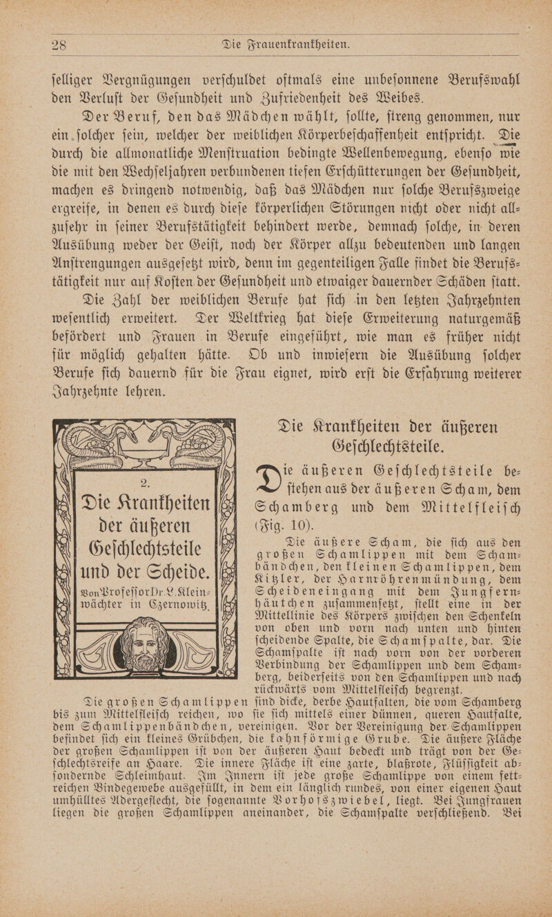 ſelliger Vergnügungen verſchuldet oftmals eine unbeſonnene Berufswahl den Verluſt der Geſundheit und Zufriedenheit des Weibes. Der Beruf, den das Mädchen wählt, ſollte, ſtreng genommen, nur ein ſolcher ſein, welcher der weiblichen Körperbeſchaffenheit entſpricht. Die durch die allmonatliche Menſtruation bedingte Wellenbewegung, ebenſo wie die mit den Wechſeljahren verbundenen tiefen Erſchütterungen der Geſundheit, machen es dringend notwendig, daß das Mädchen nur ſolche Berufszweige ergreife, in denen es durch dieſe körperlichen Störungen nicht oder nicht all— zuſehr in ſeiner Berufstätigkeit behindert werde, demnach ſolche, in deren Ausübung weder der Geiſt, noch der Körper allzu bedeutenden und langen Anſtrengungen ausgeſetzt wird, denn im gegenteiligen Falle findet die Berufs— tätigkeit nur auf Koſten der Geſundheit und etwaiger dauernder Schäden ſtatt. Die Zahl der weiblichen Berufe hat ſich in den letzten Jahrzehnten weſentlich erweitert. Der Weltkrieg hat dieſe Erweiterung naturgemäß befördert und Frauen in Berufe eingeführt, wie man es früher nicht für möglich gehalten hätte. Ob und inwiefern die Ausübung ſolcher Berufe ſich dauernd für die Frau eignet, wird erſt die Erfahrung weiterer Jahrzehnte lehren. Die Krankheiten der äußeren Geſchlechtsteile. 6 5 Dis äußeren Geſchlechtsteile be— 1 ’ 67% ſtehen aus der äußeren Scham, dem Die Krankheiten zz Schamberg und dem Mittelfleiſch der äußeren % Fig. 10). ; je) Die ä AS die f 5 d Geſchlechtsteile 1973 rohen ee 8 an ö ; bändchen, den kleinen Schamlippen, dem Ns und der Scheide. Kitzler, der Harnröhrenmündung, dem VonProfeſſor Dr. L. Klein-] Scheideneingang mit dem Jungfern⸗ wächter in Czernowitz . h äutchen zuſammenſetzt, ſtellt eine in der i RE Mittellinie des Körpers zwiſchen den Schenkeln z . — von oben und vorn nach unten und hinten ö ſcheidende Spalte, die Schamſpalte, dar. Die Schamſpalte iſt nach vorn von der vorderen Verbindung der Schamlippen und dem Scham— berg, beiderſeits von den Schamlippen und nach rückwärts vom Mittelfleiſch begrenzt. Die großen Schamlippen ſind dicke, derbe Hautfalten, die vom Schamberg bis zum Mittelfleiſch reichen, wo ſie ſich mittels einer dünnen, queren Hautfalte, dem Schamlippenbändchen, vereinigen. Vor der Vereinigung der Schamlippen befindet ſich ein kleines Grübchen, die kahn förmige Grube. Die äußere Fläche der großen Schamlippen iſt von der äußeren Haut bedeckt und trägt von der Ge— ſchlechtsreife an Haare. Die innere Fläche iſt eine zarte, blaßrote, Flüſſigkeit ab— ſondernde Schleimhaut. Im Innern iſt jede große Schamlippe von einem fett— reichen Bindegewebe ausgefüllt, in dem ein länglich rundes, von einer eigenen Haut umhülltes Adergeflecht, die ſogenannte Vorhofs zwiebel, liegt. Bei Jungfrauen liegen die großen Schamlippen aneinander, die Schamſpalte verſchließend. Bei