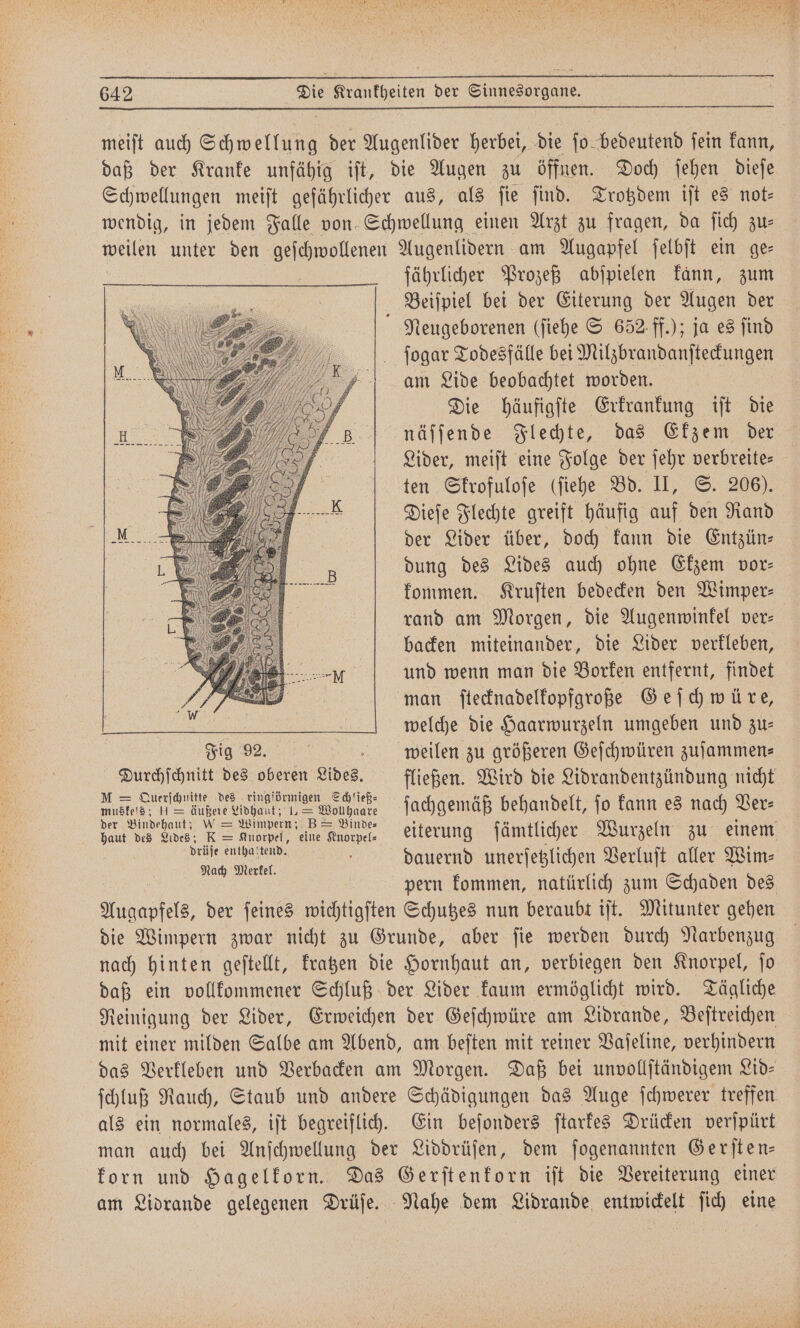 meiſt auch Schwellung der Augenlider herbei, die ſon bedeutend fein kann, daß der Kranke unfähig iſt, die Augen zu öffnen. Doch ſehen dieſe Schwellungen meiſt gefährlicher aus, als fie find. Trotzdem iſt es not— wendig, in jedem Falle von Schwellung einen Arzt zu fragen, da ſich zu⸗ weilen unter den geſchwollenen Augenlidern am Augapfel ſelbſt ein ge⸗ fährlicher Prozeß abſpielen kann, zum f Beiſpiel bei der Eiterung der Augen der Neugeborenen (ſiehe S 652 ff.); ja es ſind ſogar Todesfälle bei Nitzbrandanftertungen am Lide beobachtet worden. | Die häufigſte Erkrankung iſt Die näſſende Flechte, das Ekzem der Lider, meiſt eine Folge der ſehr verbreite— ten Skrofuloſe (ſiehe Bd. II, S. 206). Dieſe Flechte greift häufig auf den Rand der Lider über, doch kann die Entzün⸗ dung des Lides auch ohne Ekzem vor— kommen. Kruſten bedecken den Wimper— backen miteinander, die Lider verkleben, und wenn man die Borken entfernt, findet man ſtecknadelkopfgroße Geſchwü re, welche die Haarwurzeln umgeben und zu— m. wieilen zu größeren Geſchwüren zuſammen— Durchſchnitt des oberen Leides. fließen. Wird die Lidrandentzündung nicht ba a 1.2 Walhnate ſachgemäß behandelt, ſo kann es nach Ver— ban vas We F. = duorpel, eine Knorpel. eiterung ſämtlicher Wurzeln zu einem Bei EUER dauernd unerſetzlichen Verluſt aller Wim⸗ ach Merkel. pern kommen, natürlich zum Schaden des Augapfels, der ſeines wichtigſten Schutzes nun beraubt iſt. Mitunter gehen die Wimpern zwar nicht zu Grunde, aber fie werden durch Narbenzug nach hinten geſtellt, kratzen die Hornhaut an, verbiegen den Knorpel, ſo daß ein vollkommener Schluß der Lider kaum ermöglicht wird. Tägliche Reinigung der Lider, Erweichen der Geſchwüre am Lidrande, Beſtreichen mit einer milden Salbe am Abend, am beſten mit reiner Vaſeline, verhindern das Verkleben und Verbacken am Morgen. Daß bei unvollſtändigem Lid— ſchluß Rauch, Staub und andere Schädigungen das Auge ſchwerer treffen als ein normales, iſt begreiflich. Ein beſonders ſtarkes Drücken verſpürt man auch bei Anſchwellung der Liddrüſen, dem ſogenannten Gerſten— korn und Hagelkorn. Das Gerſtenkorn iſt die Vereiterung einer am Lidrande gelegenen Drüſe. Nahe dem Lidrande entwickelt ſich eine