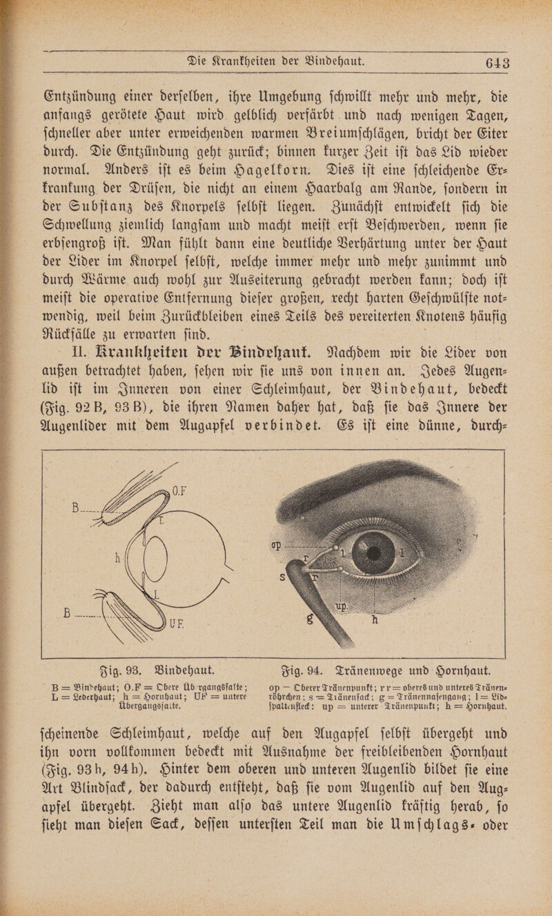 Entzündung einer derſelben, ihre Umgebung ſchwillt mehr und mehr, die anfangs gerötete Haut wird gelblich verfärbt und nach wenigen Tagen, ſchneller aber unter erweichenden warmen Breiumſchlägen, bricht der Eiter durch. Die Entzündung geht zurück; binnen kurzer Zeit iſt das Lid wieder normal. Anders iſt es beim Hagelkorn. Dies iſt eine ſchleichende Er— krankung der Drüſen, die nicht an einem Haarbalg am Rande, ſondern in der Subſtanz des Knorpels ſelbſt liegen. Zunächſt entwickelt ſich die Schwellung ziemlich langſam und macht meiſt erſt Beſchwerden, wenn ſie erbſengroß iſt. Man fühlt dann eine deutliche Verhärtung unter der Haut der Lider im Knorpel ſelbſt, welche immer mehr und mehr zunimmt und durch Wärme auch wohl zur Auseiterung gebracht werden kann; doch iſt meiſt die operative Entfernung dieſer großen, recht harten Geſchwülſte not— wendig, weil beim Zurückbleiben eines Teils des vereiterten K Knotens häufig Rückfälle zu erwarten ſind. | © II. Krankheiten der Bindehauf, Nachdem wir die Lider von außen betrachtet haben, ſehen wir ſie uns von innen an. Jedes Augen— lid iſt im Inneren von einer Schleimhaut, der Bindehaut, bedeckt (Fig. 92 B, 93), die ihren Namen daher hat, daß fie das Innere der Augenlider mit dem Augapfel verbindet. Es iſt eine dünne, durch— Bindehaut; O. F = Obere Übergangsfalte; op — Oberer Tränenpunkt; rr oberes und unteres Tränen⸗ = Lederhaut; h= Hornhaut; UF = untere röhrchen; 8 = Tränenfad; g= en 1 Lid⸗ Übergangsjalte. ſpalteufleck: up = unterer Tränenpunkt; h — Hornhaut. ſcheinende Schleimhaut, welche auf den Augapfel ſelbſt übergeht und ihn vorn vollkommen bedeckt mit Ausnahme der freibleibenden Hornhaut (Fig. 93 h, 94h). Hinter dem oberen und unteren Augenlid bildet fie eine Art Blindſack, der dadurch entſteht, daß ſie vom Augenlid auf den Aug— apfel übergeht. Zieht man alſo das untere Augenlid kräftig herab, ſo ſieht man dieſen Sack, deſſen unterſten Teil man die Umſchlags- oder