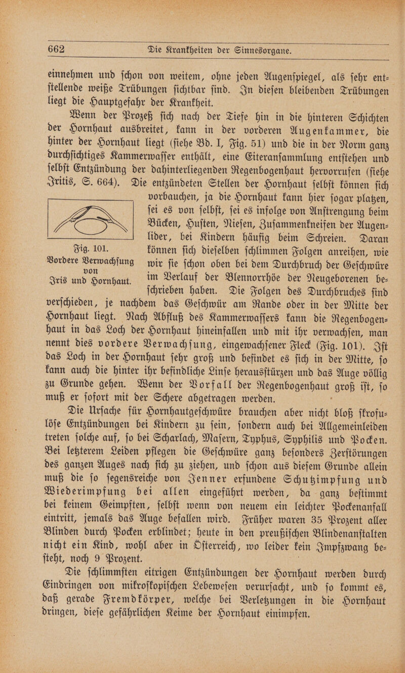 See RT RN 5 662 Die Krankheiten der Sinnesorgane. einnehmen und ſchon von weitem, ohne jeden Augenſpiegel, als ſehr ent- ſtellende weiße Trübungen ſichtbar ſind. In dieſen bleibenden Trübungen liegt die Hauptgefahr der Krankheit. | Wenn der Prozeß ſich nach der Tiefe hin in die hinteren Schichten der Hornhaut ausbreitet, kann in der vorderen Augenkammer, die hinter der Hornhaut liegt (ſiehe Bd. I, Fig. 51) und die in der Norm ganz durchſichtiges Kammerwaſſer enthält, eine Eiteranſammlung entſtehen und ſelbſt Entzündung der dahinterliegenden Regenbogenhaut hervorrufen (ſiehe vorbauchen, ja die Hornhaut kann hier ſogar platzen, ſei es von ſelbſt, ſei es infolge von Anſtrengung beim N Bücken, Huſten, Nieſen, Zuſammenkneifen der Augen⸗ lider, bei Kindern häufig beim Schreien. Daran Fig. 101. können ſich dieſelben ſchlimmen Folgen anreihen, wie Vordere 555 wir ſie ſchon oben bei dem Durchbruch der Geſchwüre Iris und Hornhaut. im Verlauf der Blennorrhöe der Neugeborenen be⸗ ſchrieben haben. Die Folgen des Durchbruches ſind verſchieden, je nachdem das Geſchwür am Rande oder in der Mitte der Hornhaut liegt. Nach Abfluß des Kammerwaſſers kann die Regenbogen⸗ haut in das Loch der Hornhaut hineinfallen und mit ihr verwachſen, man nennt dies vordere Verwachſung, eingewachſener Fleck (Fig. 101). Iſt das Loch in der Hornhaut ſehr groß und befindet es ſich in der Mitte, ſo kann auch die hinter ihr befindliche Linſe herausſtürzen und das Auge völlig zu Grunde gehen. Wenn der Vorfall der Regenbogenhaut groß iſt, ſo muß er ſofort mit der Schere abgetragen werden. x | Die Urſache für Hornhautgeſchwüre brauchen aber nicht bloß ſkrofu⸗ löſe Entzündungen bei Kindern zu ſein, ſondern auch bei Allgemeinleiden treten ſolche auf, ſo bei Scharlach, Maſern, Typhus, Syphilis und Pocken. des ganzen Auges nach ſich zu ziehen, und ſchon aus dieſem Grunde allein muß die ſo ſegensreiche von Jenner erfundene Schutzimpfung und Wiederimpfung bei allen eingeführt werden, da ganz beſtimmt bei keinem Geimpften, ſelbſt wenn von neuem ein leichter Pockenanfall eintritt, jemals das Auge befallen wird. Früher waren 35 Prozent aller Blinden durch Pocken erblindet; heute in den preußiſchen Blindenanſtalten nicht ein Kind, wohl aber in Oſterreich, wo leider kein Impfzwang be⸗ ſteht, noch 9 Prozent. | | | Die ſchlimmſten eitrigen Entzündungen der Hornhaut werden durch Eindringen von mikroſkopiſchen Lebeweſen verurſacht, und ſo kommt es, daß gerade Fremdkörper, welche bei Verletzungen in die Hornhaut dringen, dieſe gefährlichen Keime der Hornhaut einimpfen.