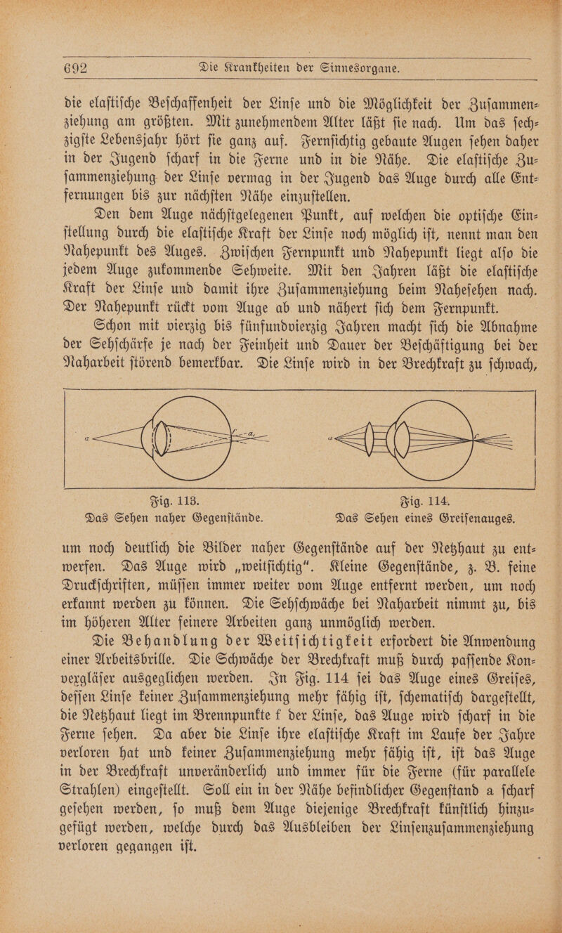 die elaſtiſche Beſchaffenheit der Linſe und die Möglichkeit der Zuſammen⸗ ziehung am größten. Mit zunehmendem Alter läßt ſie nach. Um das ſech— zigſte Lebensjahr hört ſie ganz auf. Fernſichtig gebaute Augen ſehen daher in der Jugend ſcharf in die Ferne und in die Nähe. Die elaſtiſche Zu— ſammenziehung der Linſe vermag in der Jugend das Auge durch alle Ent— fernungen bis zur nächſten Nähe einzuſtellen. Den dem Auge nächſtgelegenen Punkt, auf welchen die optiſche Ein⸗ ſtellung durch die elaſtiſche Kraft der Linſe noch möglich iſt, nennt man den Nahepunkt des Auges. Zwiſchen Fernpunkt und Nahepunkt liegt alſo die jedem Auge zukommende Sehweite. Mit den Jahren läßt die elaſtiſche Kraft der Linſe und damit ihre Zuſammenziehung beim Naheſehen nach. Der Nahepunkt rückt vom Auge ab und nähert ſich dem Fernpunkt. | Schon mit vierzig bis fünfundvierzig Jahren macht ſich die Abnahme der Sehſchärfe je nach der Feinheit und Dauer der Beſchäftigung bei der Naharbeit ſtörend bemerkbar. Die Linſe wird in der Brechkraft zu ſchwach, — | Fig. 113. Fig. 114. Das Sehen naher Gegenſtände. Das Sehen eines Greiſenauges. werfen. Das Auge wird „weitſichtig“. Kleine Gegenſtände, z. B. feine Druckſchriften, müſſen immer weiter vom Auge entfernt werden, um noch im höheren Alter feinere Arbeiten ganz unmöglich werden. Die Behandlung der Weitſichtigkeit erfordert die Anwendung einer Arbeitsbrille. Die Schwäche der Brechkraft muß durch paſſende Kon⸗ vexgläſer ausgeglichen werden. In Fig. 114 ſei das Auge eines Greiſes, deſſen Linſe keiner Zuſammenziehung mehr fähig iſt, ſchematiſch dargeſtellt, die Netzhaut liegt im Brennpunkte f der Linſe, das Auge wird ſcharf in die Ferne ſehen. Da aber die Linſe ihre elaſtiſche Kraft im Laufe der Jahre verloren hat und keiner Zuſammenziehung mehr fähig iſt, iſt das Auge Strahlen) eingeſtellt. Soll ein in der Nähe befindlicher Gegenſtand a ſcharf geſehen werden, ſo muß dem Auge diejenige Brechkraft künſtlich hinzu⸗ gefügt werden, welche durch das Ausbleiben der Linſenzuſammenziehung verloren gegangen iſt.