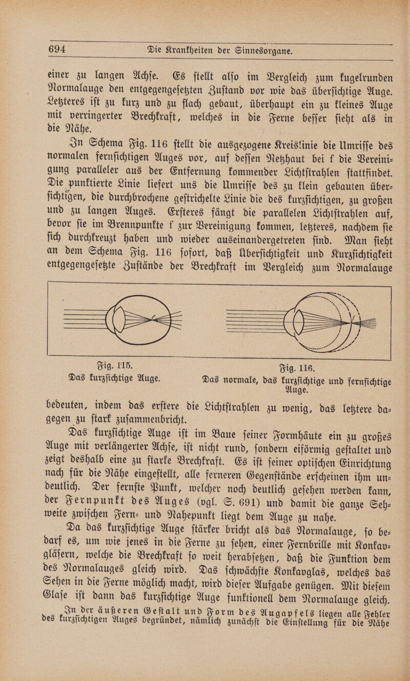 einer zu langen Achſe. Es ſtellt alfo im Vergleich zum kugelrunden Normalauge den entgegengeſetzten Zuſtand vor wie das überſichtige Auge. Letzteres iſt zu kurz und zu flach gebaut, überhaupt ein zu kleines Auge mit verringerter Brechkraft, welches in die Ferne beſſer ſieht als in die Nähe. 8 In Schema Fig. 116 ſtellt die ausgezogene Kreislinie die Umriſſe des normalen fernſichtigen Auges vor, auf deſſen Netzhaut bei k die Vereini⸗ gung paralleler aus der Entfernung kommender Lichtſtrahlen ſtattfindet. Die punktierte Linie liefert uns die Umriſſe des zu klein gebauten über⸗ ſichtigen, die durchbrochene geſtrichelte Linie die des kurzſichtigen, zu großen und zu langen Auges. Erſteres fängt die parallelen Lichtſtrahlen auf, bevor fie im Brennpunkte f zur Vereinigung kommen, letzteres, nachdem fie ſich durchkreuzt haben und wieder auseinandergetreten ſind. Man ſieht an dem Schema Fig. 116 ſofort, daß Überſichtigkeit und Kurzſichtigkeit entgegengeſetzte Zuſtände der Brechkraft im Vergleich zum Normalauge bedeuten, indem das erſtere die Lichtſtrahlen zu wenig, das letztere da⸗ gegen zu ſtark zuſammenbricht. Das kurzſichtige Auge iſt im Baue ſeiner Formhäute ein zu großes Auge mit verlängerter Achſe, iſt nicht rund, ſondern eiförmig geſtaltet und zeigt deshalb eine zu ſtarke Brechkraft. Es iſt ſeiner optiſchen Einrichtung nach für die Nähe eingeſtellt, alle ferneren Gegenſtände erſcheinen ihm un- deutlich. Der fernſte Punkt, welcher noch deutlich geſehen werden kann, der Fernpunkt des Auges (vgl. S. 691) und damit die ganze Seh: weite zwiſchen Fern⸗ und Nahepunkt liegt dem Auge zu nahe. Da das kurzſichtige Auge ſtärker bricht als das Normalauge, ſo be⸗ darf es, um wie jenes in die Ferne zu ſehen, einer Fernbrille mit Konkav⸗ gläſern, welche die Brechkraft ſo weit herabſetzen, daß die Funktion dem des Normalauges gleich wird. Das ſchwächſte Konkavglas, welches das Sehen in die Ferne möglich macht, wird dieſer Aufgabe genügen. Mit dieſem Glaſe iſt dann das kurzſichtige Auge funktionell dem Normalauge gleich. In der äußeren Geſtalt und Form des Augapfels liegen alle Fehler des kurzſichtigen Auges begründet, nämlich zunächſt die Einſtellung für die Nähe