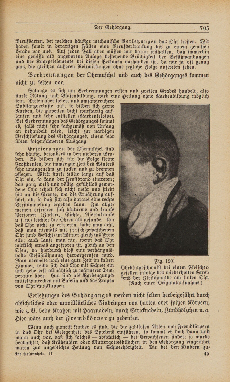 R 9 Bus IRRE) 1 * * 1 BEN a n er En re an Eee Lan Ba are Fr e Der Gehörgang. 5 3705 Berufsarten, bei welchen häufige mechanische Verletzungen das Ohr treffen. Wir haben ſomit in derartigen Fällen eine Berufserkrankung bis zu einem gewiſſen Grade vor uns. Auf jeden Fall aber müſſen wir daran feſthalten, daß immerhin eine gewiſſe als angeborene Anlage beſtehende Brüchigkeit der Gefäßwandungen und der Knorpelelemente bei dieſen Perſonen vorhanden iſt, da wir ja oft genug es, falls nicht ſehr ſachgemäß von Anfang an behandelt wird, leicht zur narbigen Verſchließung des Gehörganges, einem ſehr üblen folgenſchweren Ausgang. Erfrierungen der Ohrmuſchel ſind ſehr häufig, beſonders in den niederen Gra⸗ den. Es bilden ſich für die Folge kleine Froſtbeulen, die immer zur Zeit des Winters ſehr unangenehm zu jucken und zu brennen pflegen. Wirkt ſtarke Kälte lange auf das Ohr ein, ſo kann der Froſtbrand eintreten; das ganz weiß und völlig gefühllos gewor⸗ dene Ohr erholt ſich nicht mehr und ſtirbt bis an die Grenze, wo die Ernährung auf⸗ hört, ab, ſo daß ſich alſo daraus eine rechte Verſtümmelung ergeben kann. Im allge⸗ meinen erfrieren ſich blutarme und kranke Perſonen (Zucker⸗, Gicht⸗, Nierenkranke u f. w.) leichter die Ohren als geſunde. Um das Ohr nicht zu erfrieren, habe man acht, daß man niemals mit friſch gewaſchenem Ohr (und Geſicht) im Winter gleich ins Freie eile; auch laufe man nie, wenn das Ohr wirklich etwas angefroren iſt, gleich an den Ofen, da hierdurch bloß eine verhängnis⸗ volle Gefäßlähmung hervorgerufen wird. . Man verweile noch eine gute Zeit im kalten Fig. 120. perle über. Gut find ais Vorbeugunge: gelelen infolge bes an danken Ohr . . ; ; ; N en er e . en e en aſelin und das Tragen (Nach einer Originalaufnahme.) Verletzungen des Gehörganges werden nicht ſelten herbeigeführt durch abſichtliches oder unwillkürliches Eindringen von harten oder ſpitzen Körpern, wie z. B. beim Kratzen mit Haarnadeln, durch Stricknadeln, Zündhölzchen u. a. Hier wäre auch der Fremdkörper zu gedenken. Wenn auch zumeiſt Kinder es ſind, die die zahlloſen Arten von Fremdkörpern wann auch vor, daß ſich ſolches — abſichtlich — bei Erwachſenen findet; ſo wurde beobachtet, daß Krähenhirn oder Muttergottesbildchen in den eb den ar waren zur angeblichen Heilung von Schwerhörigkeit. Die bei den Kindern zu⸗ Die Geſundheit. II. 45