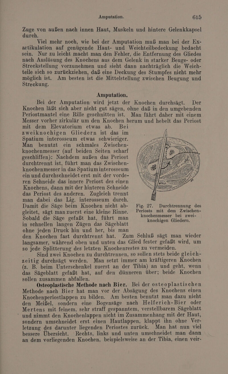 EN außen nach innen Haut, Muskeln und hintere Gelenkkapsel urch. | Viel mehr noch, wie bei der Amputation muß man bei der Ex- artikulation auf genügende Haut- und Weichteilbedeckung bedacht sein. Nur zu leicht macht man den Fehler, die Entfernung des Gliedes nach Auslösung des Knochens aus dem Gelenk in starker Beuge- oder Streckstellung vorzunehmen und sieht dann nachträglich die Weich- teile sich so zurückziehen, daß eine Deckung des Stumpfes nicht mehr möglich ist. Am besten ist die Mittelstellung zwischen Beugung und Streckung. Amputation. Bei der Amputation' wird jetzt der Knochen durchsägt. Der Knochen läßt sich aber nicht gut sägen, ohne daß in den umgebenden Periostmantel eine Rille geschnitten ist. Man fährt daher mit einem Messer vorher zirkulär um den Knochen herum und hebelt das Periost mit dem Elevatorium etwas ab. Bei zweiknochigen Gliedern ist das im Spatium interosseum etwas schwieriger. Man benutzt ein schmales Zwischen- knochenmesser (auf beiden Seiten scharf geschlifien): Nachdem außen das Periost durchtrennt ist, führt man das Zwischen- knochenmesser in das Spatiuminterosseum ein und durchschneidet erst mit der vorde- ren Schneide das innere Periost des einen Knochens, dann mit der hinteren Schneide das Periost des anderen. Zugleich trennt man dabei das Lig. interosseum durch. = Damit die Säge beim Knochen nicht ab- Fig. 27. Durchtrennung des gleitet, sägt man zuerst eine kleine Rinne. Periosts mit dem Zwischen- Sobald die Säge gefaßt hat, führt man En ee . &amp; A gen Gliedern. in schnellen langen Zügen das Sägeblatt ohne jeden Druck hin und her, bis man | den Knochen fast durchtrennt hat. Zum Schluß sägt man wieder langsamer, während oben und unten das Glied fester gefaßt wird, um so jede Splitterung des letzten Knochenrestes zu vermeiden. | Sind zwei Knochen zu durchtrennen, so sollen stets beide gleich- zeitig durchsägt werden. Man setzt immer am kräftigeren Knochen (z. B. beim Unterschenkel zuerst an der Tibia) an und geht, wenn das Sägeblatt gefaßt hat, auf den dünneren über; beide Knochen sollen zusammen abfallen. Osteoplastische Methode nach Bier. Bei der osteoplastischen Methode nach Bier hat man vor der Absägung des Knochens einen Knochenperiostlappen zu bilden. Am besten benutzt man dazu nicht den Meißel, sondern eine Bogensäge nach Helferich-Bier oder Mertens mit feinem, sehr straff gespanntem, verstellbarem Sägeblatt “ und nimmt den Knochenlappen nicht im Zusammenhang mit der Haut, sondern umschneidet erst einen Hautlappen, klappt ihn ohne Ver- letzung des darunter liegenden Periostes zurück. Man hat nun viel bessere Übersicht. Rechts, links und unten umschneidet man dann an dem vorliegenden Knochen, beispielsweise an der Tibia, einen veir-