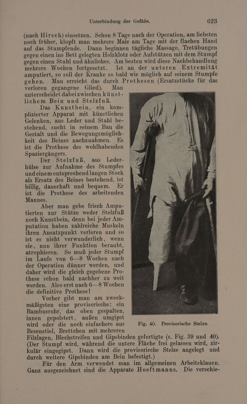 (nach Hirsch) einsetzen. Schon 8 Tage nach der Operation, am liebsten noch früher, klopft man mehrere Male am Tage mit der flachen Hand auf das Stumpfende. Dann beginnen tägliche Massage, Tretübungen gegen einen ins Bett gelegten Holzklotz oder Aufstützen mit dem Stumpf gegen einen Stuhl und ähnliches. Am besten wird diese Nachbehandlung mehrere Wochen fortgesetzt. Ist an der unteren Extremität amputiert, so soll der Kranke so bald wie möglich auf seinem Stumpfe gehen. Man erreicht das durch Prothesen (Ersatzstücke für das verloren gegangene Glied. Man unterscheidet dabeizwischen künst- lichem Bein und Stelziuß. Das Kunstbein, ein kom- plizierter Apparat mit künstlichen Gelenken, aus Leder und Stahl be- stehend, sucht in seinem Bau die Gestalt und die Bewegungsmöglich- keit des Beines nachzuahmen. Es ist die Prothese des wohlhabenden Spaziergängers. Der Stelzfuß, aus Leder- hülse zur Aufnahme des Stumpfes und einem entsprechend langen Stock als Ersatz des Beines bestehend, ist billig, dauerhaft und bequem. Er ist die Prothese des arbeitenden Mannes. | Aber man gebe frisch Ampu- tierten zur Stütze weder Stelzfuß noch Kunstbein, denn bei jeder Am- putation haben zahlreiche Muskeln ihren Ansatzpunkt verloren und so ist es nicht verwunderlich, wenn sie, nun ihrer Funktion beraubt, atrophieren. So muß jeder Stumpf im Laufe von 6—8 Wochen nach der Operation dünner werden, und daher wird die gleich gegebene Pro- these schon bald nachher zu weit werden. Also erst nach 6—8 Wochen die definitive Prothese! Vorher gibt man am zweck- mäßigsten eine provisorische: ein Bambusrohr, das oben gespalten, innen gepolstert, außen umgipst | wird oder die noch einfachere aus Fig. 40. Provisorische Stelze. Besenstiel, Brettehen mit mehreren | Filzlagen, Blechstreifen und Gipsbinden gefertigte (s. Fig. 39 und 40). (Der Stumpf wird, während die untere Fläche frei gelassen wird, zir- kulär eingegipst. Dann wird die provisorische Stelze angelegt und durch weitere Gipsbinden am Bein befestigt.) | Für den Arm verwendet man im allgemeinen Arbeitsklauen. — Ganz ausgezeichnet sind die Apparate Hoeftmanns. Die verschie-