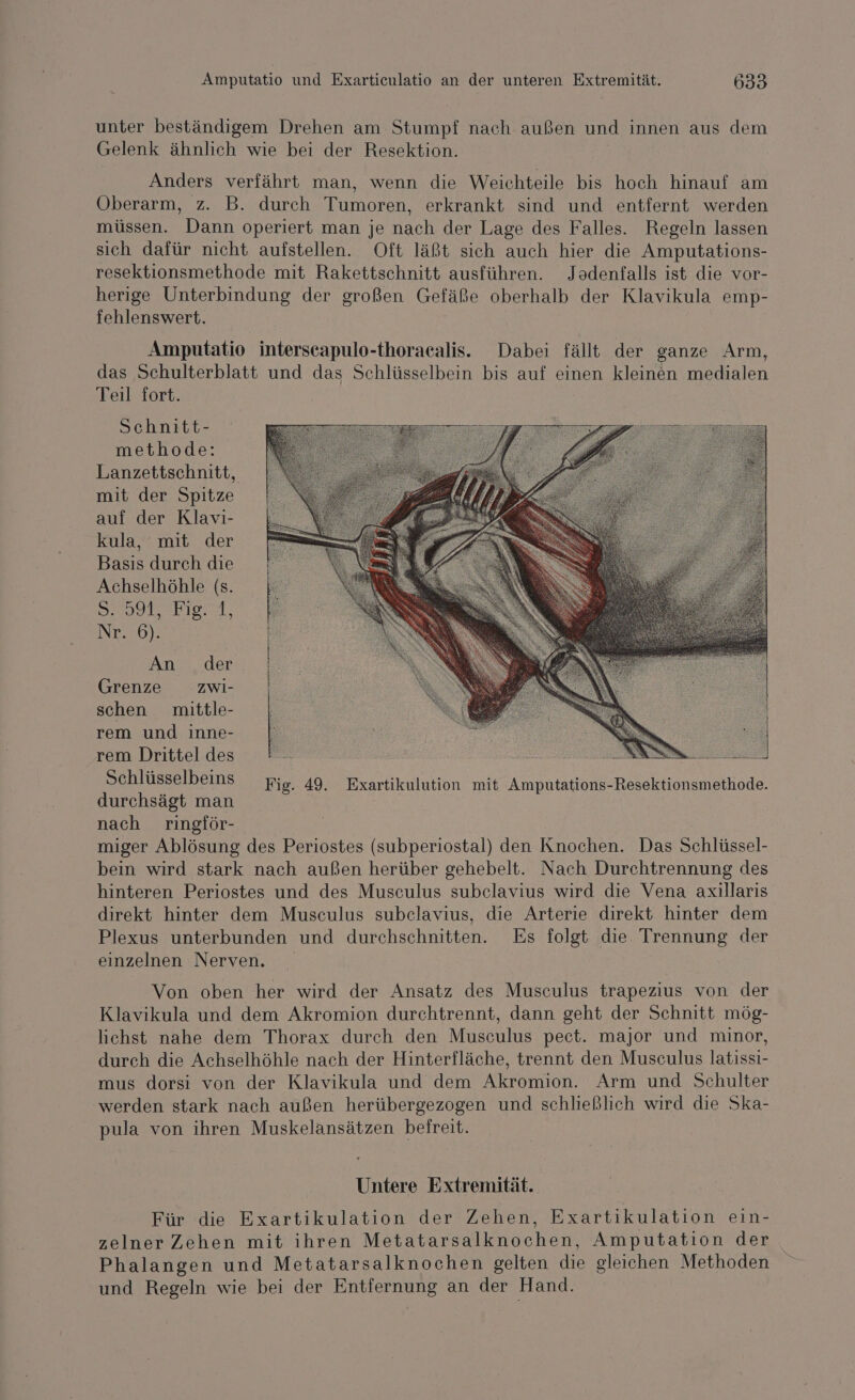 unter beständigem Drehen am Stumpf nach außen und innen aus dem Gelenk ähnlich wie bei der Resektion. Anders verfährt man, wenn die Weichteile bis hoch hinauf am Oberarm, z. B. durch Tumoren, erkrankt sind und entfernt werden müssen. Dann operiert man je nach der Lage des Falles. Regeln lassen sich dafür nicht aufstellen. Oft läßt sich auch hier die Amputations- resektionsmethode mit Rakettschnitt ausführen. Jodenfalls ist die vor- herige Unterbindung der großen Gefäße oberhalb der Klavikula emp- fehlenswert. Amputatio interscapulo-thoracalis. Dabei fällt der ganze Arm, das Schulterblatt und das Schlüsselbein bis auf einen kleinen medialen Teil dort. Schnitt- methode: Lanzettschnitt, mit der Spitze auf der Klavi- kula, mit der Basis durch die Achselhöhle (s. SEITE OrRl, Nr230). An der Grenze zwi- schen mittle- rem und inne- rem Drittel des Schlüsselbeins durchsägt man nach ringför- miger Ablösung des Periostes (subperiostal) den Knochen. Das Schlüssel- bein wird stark nach außen herüber gehebelt. Nach Durchtrennung des hinteren Periostes und des Musculus subelavius wird die Vena axillaris direkt hinter dem Musculus subelavius, die Arterie direkt hinter dem Plexus unterbunden und durchschnitten. Es folgt die Trennung der einzelnen Nerven, Von oben her wird der Ansatz des Musculus trapezius von der Klavikula und dem Akromion durchtrennt, dann geht der Schnitt mög- lichst nahe dem Thorax durch den Musculus pect. major und minor, durch die Achselhöhle nach der Hinterfläche, trennt den Musculus latissi- mus dorsi von der Klavikula und dem Akromion. Arm und Schulter ‚werden stark nach außen herübergezogen und schließlich wird die Ska- pula von ihren Muskelansätzen befreit. Untere Extremität. Für die Exartikulation der Zehen, Exartikulation eın- zelner Zehen mit ihren Metatarsalknochen, Amputation der Phalangen und Metatarsalknochen gelten die gleichen Methoden und Regeln wie bei der Entfernung an der Hand.