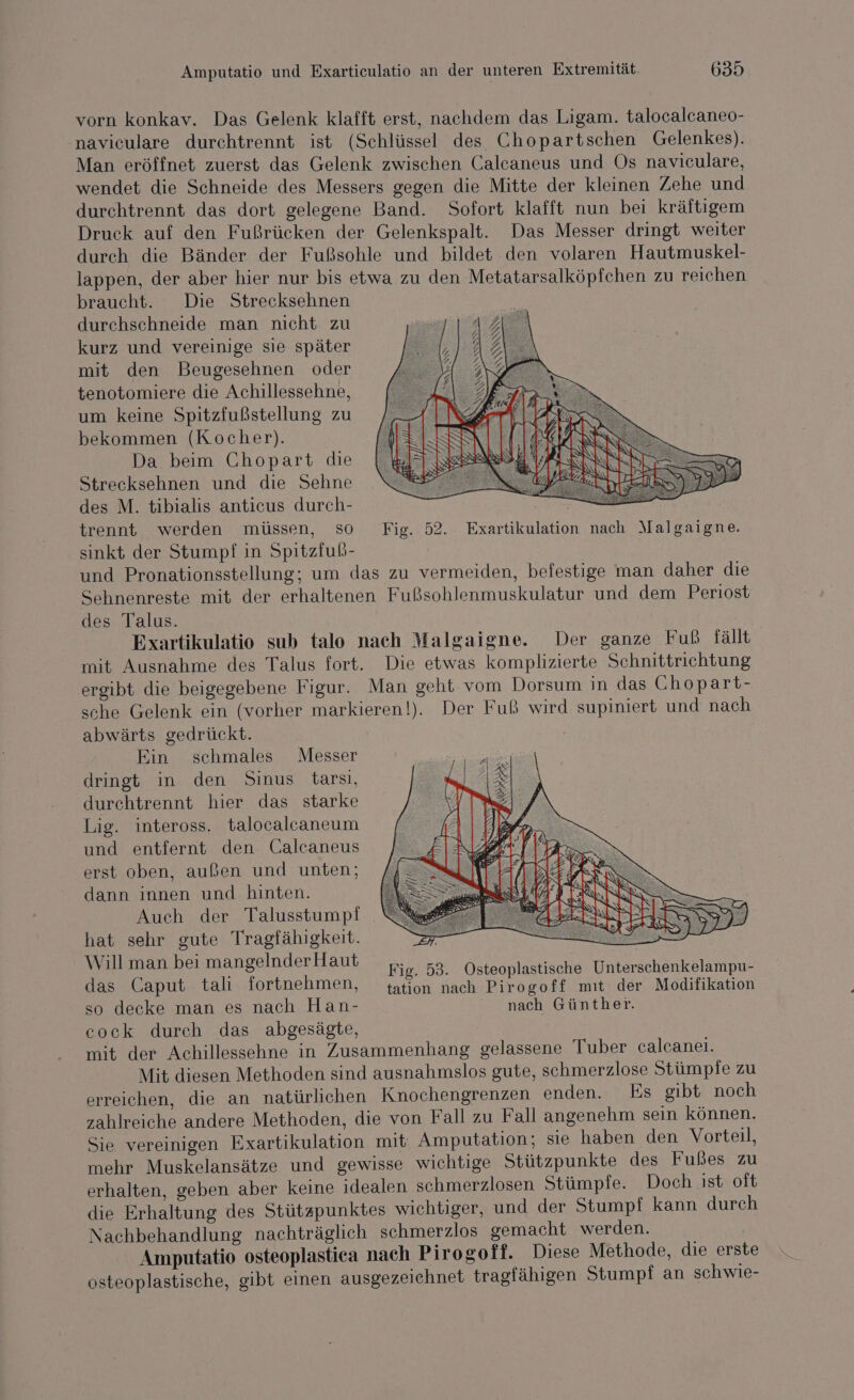 vorn konkav. Das Gelenk klafft erst, nachdem das Ligam. talocalcaneo- naviculare durchtrennt ist (Schlüssel des Chopartschen Gelenkes). Man eröffnet zuerst das Gelenk zwischen Calcaneus und Os naviculare, wendet die Schneide des Messers gegen die Mitte der kleinen Zehe und durchtrennt das dort gelegene Band. Sofort klafft nun bei kräftigem Druck auf den Fußrücken der Gelenkspalt. Das Messer dringt weiter durch die Bänder der Fußsohle und bildet den volaren Hautmuskel- lappen, der aber hier nur bis etwa zu den Metatarsalköpfehen zu reichen braucht. Die Strecksehnen durchschneide man nicht zu kurz und vereinige sie später mit den Beugesehnen oder tenotomiere die Achillessehne, um keine Spitzfußstellung zu bekommen (Kocher). Da beim Chopart die Strecksehnen und die Sehne des M. tibialis anticus durch- trennt werden müssen, SO Fig. 52. Exartikulation nach Malgaigne. sinkt der Stumpf in Spitzfuß- | und Pronationsstellung; um das zu vermeiden, befestige man daher die Sehnenreste mit der erhaltenen Fußsohlenmuskulatur und dem Periost des Talus. Exartikulatio sub talo nach Malgaigne. Der ganze Fuß fällt mit Ausnahme des Talus fort. Die etwas komplizierte Schnittrichtung ergibt die beigegebene Figur. Man geht vom Dorsum in das Chopart- sche Gelenk ein (vorher markieren!). Der Fuß wird supiniert und nach abwärts gedrückt. | Ein schmales Messer dringt in den Sinus tarsi, durchtrennt hier das starke Lig. inteross. talocalcaneum und entfernt den Calcaneus erst oben, außen und unten; dann innen und hinten. Auch der Talusstumpi N hat sehr gute Tragfähigkeit. Klmanbeı mangelnder Haut Fie. 53. Osteoplastische Unterschenkelampu- das Caput tali fortnehmen, tation nach Pirogoff mıt der Modifikation so decke man es nach Han- nach Günther. cock durch das abgesägte, mit der Achillessehne in Zusammenhang gelassene Tuber calcanei. Mit diesen Methoden sind ausnahmslos gute, schmerzlose Stümpie zu erreichen, die an natürlichen Knochengrenzen enden. Es gibt noch zahlreiche andere Methoden, die von Fall zu Fall angenehm sein können. Sie vereinigen Exartikulation mit Amputation; sie haben den Vorteil, mehr Muskelansätze und gewisse wichtige Stützpunkte des Fußes zu erhalten, geben aber keine idealen schmerzlosen Stümpfe. Doch ist oft die Erhaltung des Stützpunktes wichtiger, und der Stumpf kann durch Nachbehandlung nachträglich schmerzlos gemacht werden. Amputatio osteoplastica nach Pirogoff. Diese Methode, die erste osteoplastische, gibt einen ausgezeichnet tragfähigen Stumpf an schwie-