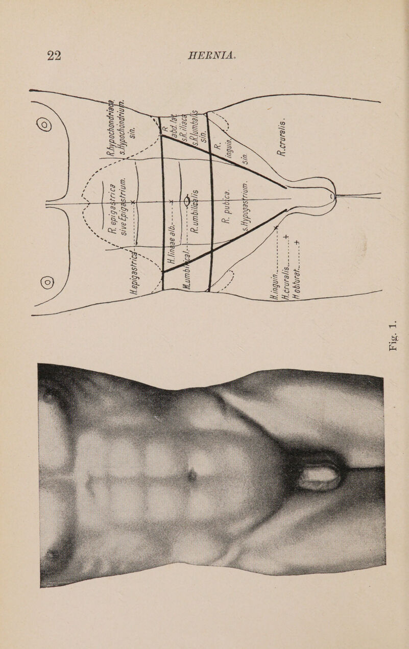 FO esnyge + eddy SIENA d San ue ae US oe ee eke here ee ~poiasebida'y) ‘unupuoysodhys f, wnuuisebidgans \ ebempuoygodiyy\\ — eaiayeebida yf [31