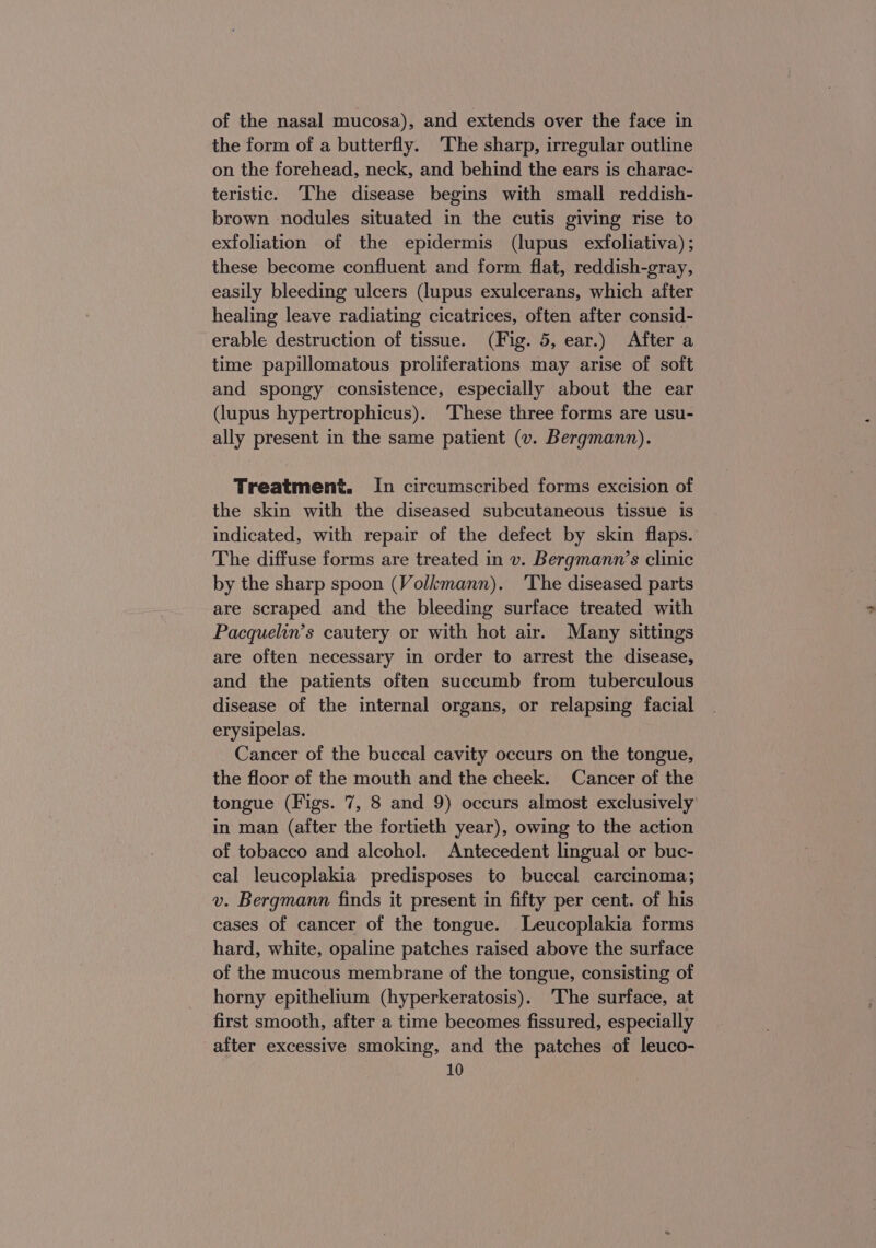 of the nasal mucosa), and extends over the face in the form of a butterfly. ‘The sharp, irregular outline on the forehead, neck, and behind the ears is charac- teristic. The disease begins with small reddish- brown nodules situated in the cutis giving rise to exfoliation of the epidermis (lupus exfoliativa); these become confluent and form flat, reddish-gray, easily bleeding ulcers (lupus exulcerans, which after healing leave radiating cicatrices, often after consid- erable destruction of tissue. (Fig. 5, ear.) After a time papillomatous proliferations may arise of soft and spongy consistence, especially about the ear (lupus hypertrophicus). ‘These three forms are usu- ally present in the same patient (v. Bergmann). Treatment. In circumscribed forms excision of the skin with the diseased subcutaneous tissue is indicated, with repair of the defect by skin flaps. The diffuse forms are treated in v. Bergmann’s clinic by the sharp spoon (Volkmann). The diseased parts are scraped and the bleeding surface treated with Pacquelin’s cautery or with hot air. Many sittings are often necessary in order to arrest the disease, and the patients often succumb from tuberculous disease of the internal organs, or relapsing facial erysipelas. Cancer of the buccal cavity occurs on the tongue, the floor of the mouth and the cheek. Cancer of the tongue (Figs. 7, 8 and 9) occurs almost exclusively in man (after the fortieth year), owing to the action of tobacco and alcohol. Antecedent lingual or buc- cal leucoplakia predisposes to buccal carcinoma; v. Bergmann finds it present in fifty per cent. of his cases of cancer of the tongue. Leucoplakia forms hard, white, opaline patches raised above the surface of the mucous membrane of the tongue, consisting of horny epithelium (hyperkeratosis). ‘The surface, at first smooth, after a time becomes fissured, especially after excessive smoking, and the patches of leuco- 10