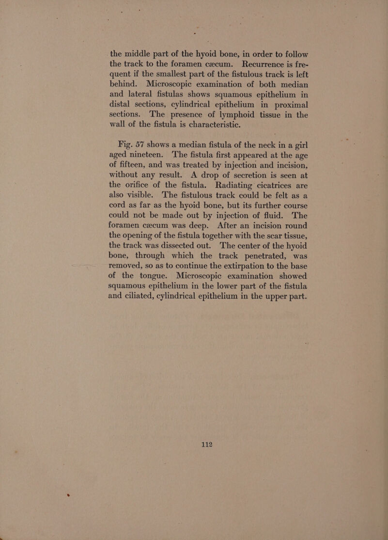 ‚the middle part of the hyoid bone, in order to follow the track to the foramen cecum. Recurrence is fre- quent if the smallest part of the fistulous track is left behind. Microscopic examination of both median and lateral fistulas shows squamous epithelium in distal sections, cylindrical epithelium in proximal sections. ‘I'he presence of lymphoid tissue in the wall of the fistula is characteristic. Fig. 57 shows a median fistula of the neck in a girl aged nineteen. The fistula first appeared at the age of fifteen, and was treated by injection and incision, without any result. A drop of secretion is seen at the orifice of the fistula. Radiating cicatrices are also visible. ‘The fistulous track could be felt as a cord as far as the hyoid bone, but its further course could not be made out by injection of fluid. The foramen ceecum was deep. After an incision round the opening of the fistula together with the scar tissue, the track was dissected out. The center of the hyoid bone, through which the track penetrated, was removed, so as to continue the extirpation to the base of the tongue. Microscopic examination showed squamous epithelium in the lower part of the fistula and ciliated, cylindrical epithelium in the upper part.