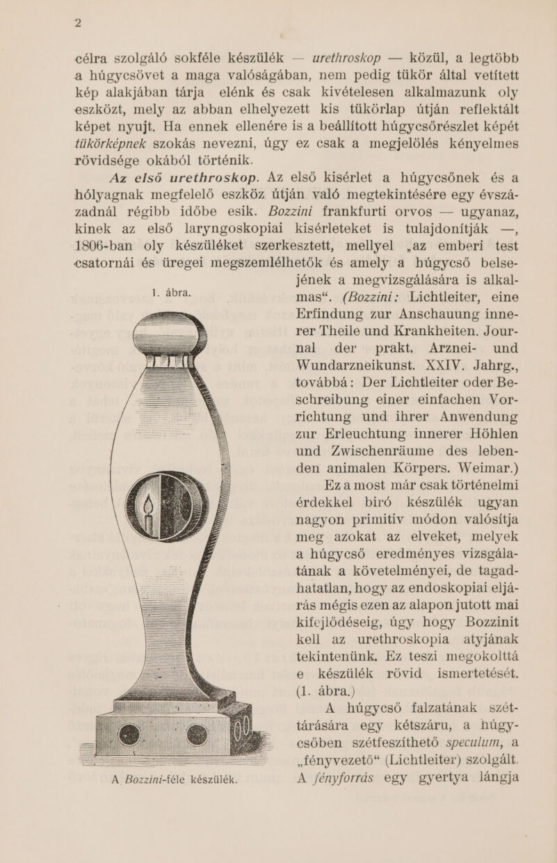 jé célra szolgáló sokféle készülék — urethroskopn — közül, a legtöbb a húgycsövet a maga valóságában, nem pedig tükör által vetített kép alakjában tárja elénk és csak kivételesen alkalmazunk oly eszközt, mely az abban elhelyezett kis tükörlap útján reflektált képet nyujt. Ha ennek ellenére is a beállított húgycsőrészlet képét tükörképnek szokás nevezni, úgy ez csak a megjelölés kényelmes rövidsége okából történik. Az első urethroskop. Az első kisérlet a húgycsőnek és a hólyagnak megfelelő eszköz útján való megtekintésére egy évszá- zadnál régibb időbe esik. Bozzini frankfurti orvos — ugyanaz, kinek az első laryngoskopiai kisérleteket is tulajdonítják —, 1806-ban oly készüléket szerkesztett, mellyel ,az emberi test csatornái és üregei megszemlélhetők és amely a húgycső belse- jének a megvizsgálására is alkal- mas. (Bozzini: Lichtleiter, eine EE Erfindung zur Anschauung inne- jz rer Theile und Krankheiten. Jour- nal der prakt. Arznei- und Wundarzneikunst. XXIV. Jahrg., továbbá: Der Lichtleiter oder Be- schreibung einer einfachen Vor- richtung und ihrer Anwendung zur Erleuchtung innerer Höhlen und Zwischenráume des leben- den animalen Körpers. Weimar.) Ez a most már csak történelmi érdekkel biró készülék ugyan nagyon primitiv módon valósítja meg azokat az elveket, melyek a húgycső eredményes vizsgála- tának a követelményei, de tagad- hatatlan, hogy az endoskopiai eljá- rás mégis ezen az alapon jutott mai kifejlődéseig, úgy hogy Bozzinit kell az urethroskopia atyjának tekintenünk. Ez teszi megokolttá e készülék rövid ismertetését. (1. ábra.) A húgycsó falzatának szét- Hi NI! § . — tárására egy kétszáru, a húgy- A  ! Ni  IVESE- — csőben szétfeszíthető speculum, a ES se , fényvezető (Lichtleiter) szolgált. A. Bozzini-féle készülék. A fényforrás egy gyertya lángja T ma TT Tt NI AH! j