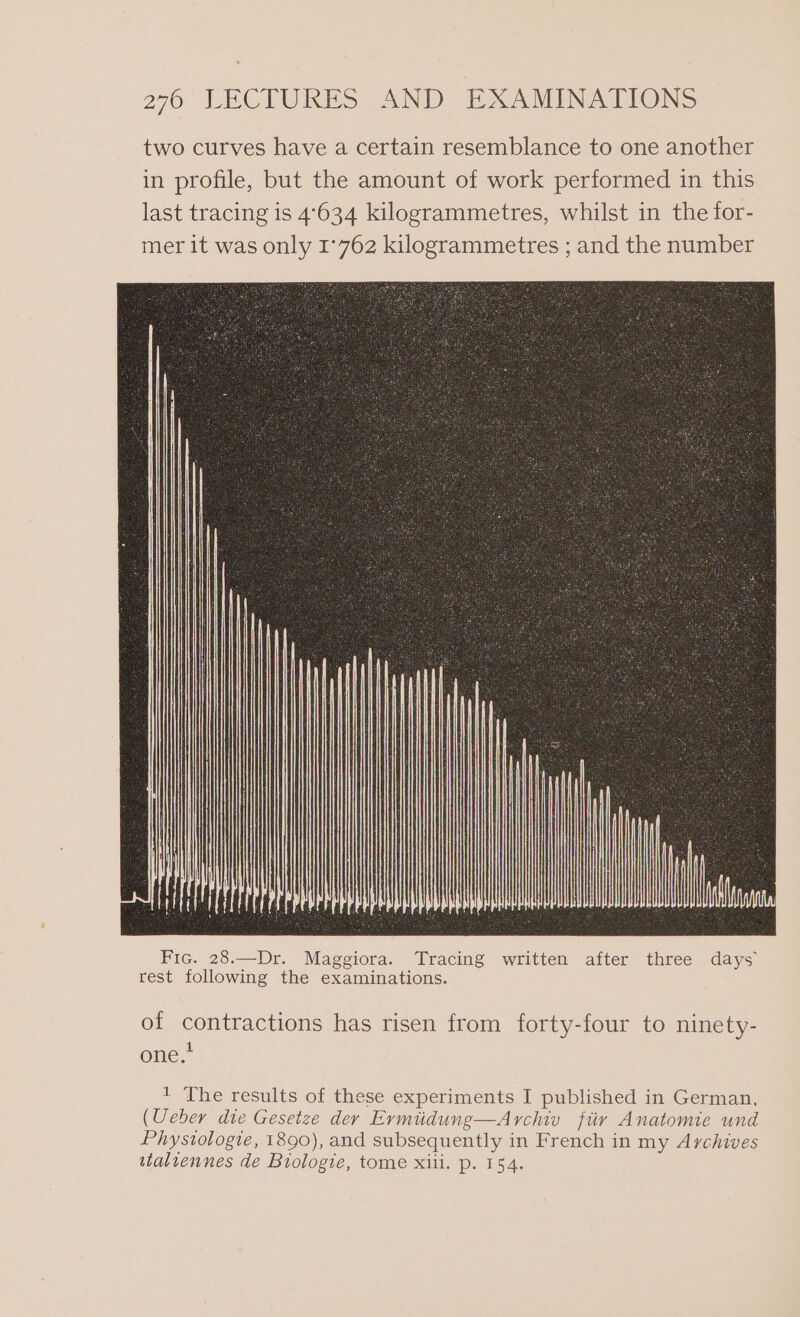 two curves have a certain resemblance to one another in profile, but the amount of work performed in this last tracing is 4°634 kilogrammetres, whilst in the for- mer it was only 1:762 kilogrammetres ; and the number Fic. 28.—Dr. Maggiora. Tracing written after three days rest following the examinations. of contractions has risen from forty-four to ninety- one. 1 The results of these experiments I published in German, (Ueber die Gesetze der Ermidung—Archiv fiir Anatomie und Phystologie, 1890), and subsequently in French in my Archives taliennes de Biologie, tome xii. p. 154.