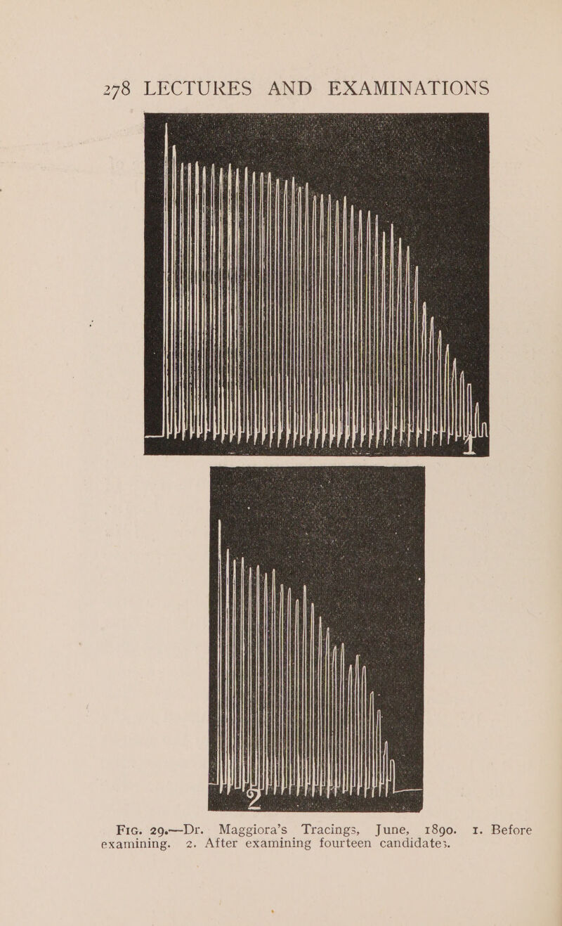 Fic. 29.—Dr. Maggiora’s Tracings, June, 1890. 1. Before examining. 2. After examining fourteen candidates.