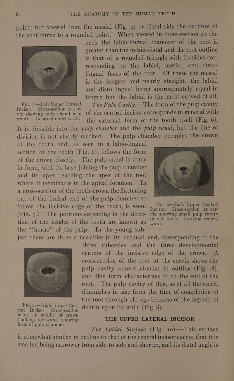 point; but viewed from the mesial (Fig. 3) or distal side the outlines of the root curve to a rounded point. When viewed in cross-section at the neck the labio-lingual diameter of the root is greater than the mesio-distal and the root outline is that of a rounded triangle with its sides cor- responding to the labial, mesial, and disto- lingual faces of the root. Of these the mesial is the longest and nearly straight, the labial and disto-lingual being approximately equal in length but the labial is the most curved of all. Fic. 7.—Left Upper Central = [he Pulp Cavity—The form of the pulp cavity Incisor. Cross-section at cer- SOR : : vix showing pulp chamber in of the central incisor corresponds in general with crown. Looking crownward. the external form of the tooth itself (Fig. 6). It is divisible into the pulp chamber and the pulp canal, but the line of division is not clearly marked. The pulp chamber occupies the crown of the tooth and, as seen in a labio-lingual section of the tooth (Fig. 6), follows the form of the crown closely. The pulp canal is conic in form, with its base joining the pulp chamber and its apex reaching the apex of the root where it terminates in the apical foramen. In a cross-section of the tooth-crown the flattening out of the incisal end of the pulp chamber to follow the incisive edge of the tooth, is seen. , Fic. 8.—Left Upper Central ncisor. Cross-section at cer- (Fig. 9.) The portions extending in the direc- vix showing small pulp cavity tion of the angles of the tooth are known as pak seem spe ot the “horns” of the pulp. In the young sub- ject there are three concavities in its occlusal end, corresponding to the | three tubercles and the three developmental centers of the incisive edge of the crown. A cross-section of the root at the cervix shows the pulp cavity almost circular in outline (Fig. 8), and this form characterizes it to the end of the root. The pulp cavity of this, as of all the teeth, diminishes in size from the time of completion of the root through old age because of the deposit of dentin upon its walls (Fig. 8). Fic. 9.—Right Upper Cen- tral Incisor. Cross-section made at middle of crown (looking rootward) showing THE UPPER LATERAL INCISOR form of pulp chamber. j The Labial Surface (Fig. 10).—This surface is somewhat similar in outline to that of the central incisor except that it is smaller, being narrower from side to side and shorter, and its distal angle is