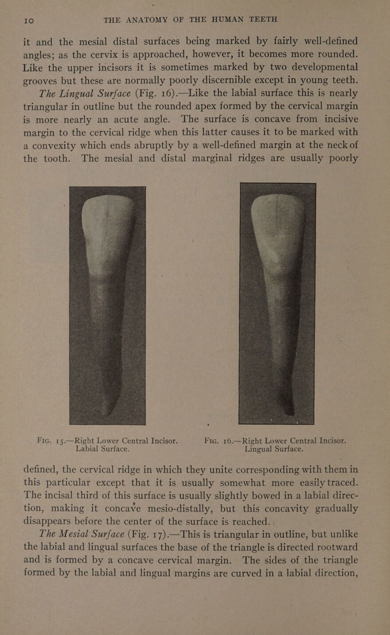 it and the mesial distal surfaces being marked by fairly well-defined angles; as the cervix is approached, however, it becomes more rounded. Like the upper incisors it is sometimes marked by two developmental grooves but these are normally poorly discernible except in young teeth. The Lingual Surface (Fig. 16).—Like the labial surface this is nearly triangular in outline but the rounded apex formed by the cervical margin is more nearly an acute angle. The surface is concave from incisive margin to the cervical ridge when this latter causes it to be marked with a convexity which ends abruptly by a well-defined margin at the neck of the tooth. The mesial and distal marginal ridges are usually poorly Fic. 15.—Right Lower Central Incisor. ’ Fic. 16.—Right Lower Central Incisor. Labial Surface. Lingual Surface. defined, the cervical ridge in which they unite corresponding with them in this particular except that it is usually somewhat more easily traced. The incisal third of this surface is usually slightly bowed in a labial direc- tion, making it concave mesio-distally, but this concavity gradually disappears before the center of the surface is reached. The Mesial Surface (Fig. 17) —This is triangular in outline, but unlike the labial and lingual surfaces the base of the triangle is directed rootward and is formed by a concave cervical margin. The sides of the triangle formed by the labial and lingual margins are curved in a labial direction,