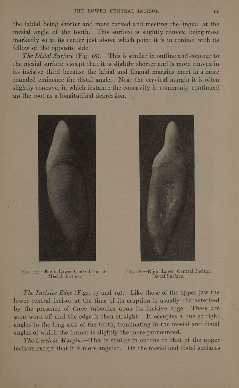 the labial being shorter and more curved and meeting the lingual at the mesial angle of the tooth. This surface is slightly convex, being most markedly so at its center just above which point it is in contact with its fellow of the opposite side. The Distal Surface (Fig. 18).—This is similar in outline and contour to the mesial surface, except that it is slightly shorter and is more convex in its incisive third because the labial and lingual margins meet in a more rounded eminence the distal angle.. Near the cervical margin it is often slightly concave, in which instance the concavity is commonly continued up the root as a longitudinal depression. Fic. 17.—Right Lower Central Incisor. Fic. 18.—Right Lower Central Incisor. Mesial Surface. Distal Surface. The Incisive Edge (Figs. 15 and 19).—Like those of the upper jaw the lower central incisor at the time of its eruption is usually characterized by the presence of three tubercles upon its incisive edge. These are soon worn off and the edge is then straight. It occupies a line at right angles to the long axis of the tooth, terminating in the mesial and distal angles of which the former is slightly the more pronounced. The Cervical Margin.—This is similar in outline to that of the upper incisors except that it is more angular. On the mesial and distal surfaces