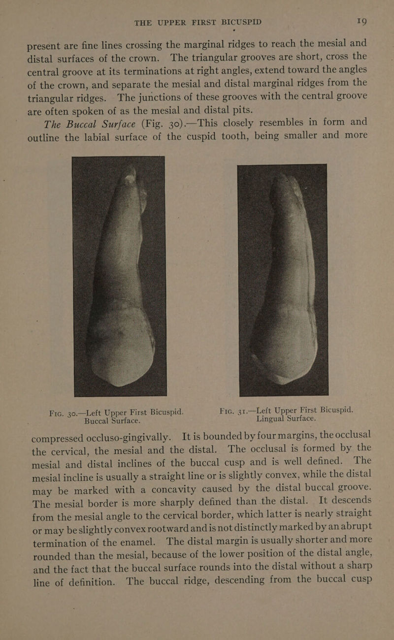 present are fine lines crossing the marginal ridges to reach the mesial and distal surfaces of the crown. The triangular grooves are short, cross the central groove at its terminations at right angles, extend toward the angles of the crown, and separate the mesial and distal marginal ridges from the triangular ridges. The junctions of these grooves with the central groove are often spoken of as the mesial and distal pits. The Buccal Surface (Fig. 30).—This closely resembles in form and outline the labial surface of the cuspid tooth, being smaller and more Fic. 30.—Left Upper First Bicuspid. Fic. 31.—Left Upper First Bicuspid. Buccal Surface. Lingual Surface. compressed occluso-gingivally. It is bounded by four margins, the occlusal the cervical, the mesial and the distal. The occlusal is formed by the mesial and distal inclines of the buccal cusp and is well defined. The mesial incline is usually a straight line or is slightly convex, while the distal may be marked with a concavity caused by the distal buccal groove. The mesial border is more sharply defined than the distal. It descends from the mesial angle to the cervical border, which latter is nearly straight or may beslightly convex rootward and is not distinctly marked by anabrupt termination of the enamel. The distal margin is usually shorter and more rounded than the mesial, because of the lower position of the distal angle, and the fact that the buccal surface rounds into the distal without a sharp line of definition. The buccal ridge, descending from the buccal cusp