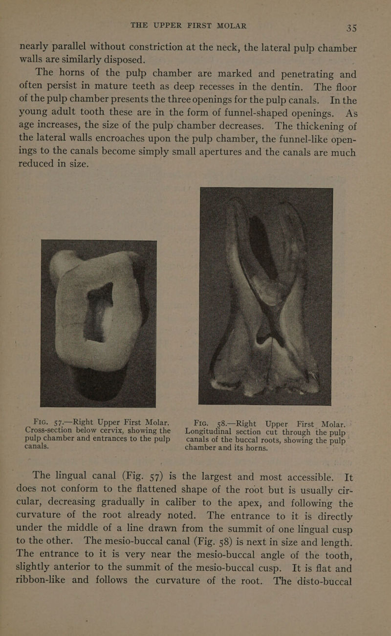 nearly parallel without constriction at the neck, the lateral pulp chamber walls are similarly disposed. | . The horns of the pulp chamber are marked and penetrating and often persist in mature teeth as deep recesses in the dentin. The floor of the pulp chamber presents the three openings for the pulp canals. Inthe young adult tooth these are in the form of funnel-shaped openings. As age increases, the size of the pulp chamber decreases. The thickening of the lateral walls encroaches upon the pulp chamber, the funnel-like open- ings to the canals become simply small apertures and the canals are much reduced in size. Fic. 57.—Right Upper First Molar. Fic. 58.—Right Upper First Molar. \— Cross-section below cervix, showing the Longitudinal section cut through the pulp pulp chamber and entrances to the pulp canals of the buccal roots, showing the pulp canals. chamber and its horns. oy The lingual canal (Fig. 57) is the largest and most accessible. It does not conform to the flattened shape of the root but is usually cir- cular, decreasing gradually in caliber to the apex, and following the curvature of the root already noted. The entrance to it is directly under the middle of a line drawn from the summit of one lingual cusp to the other. The mesio-buccal canal (Fig. 58) is next in size and length. The entrance to it is very near the mesio-buccal angle of the tooth, slightly anterior to the summit of the mesio-buccal cusp. It is flat and ribbon-like and follows the curvature of the root. The disto-buccal